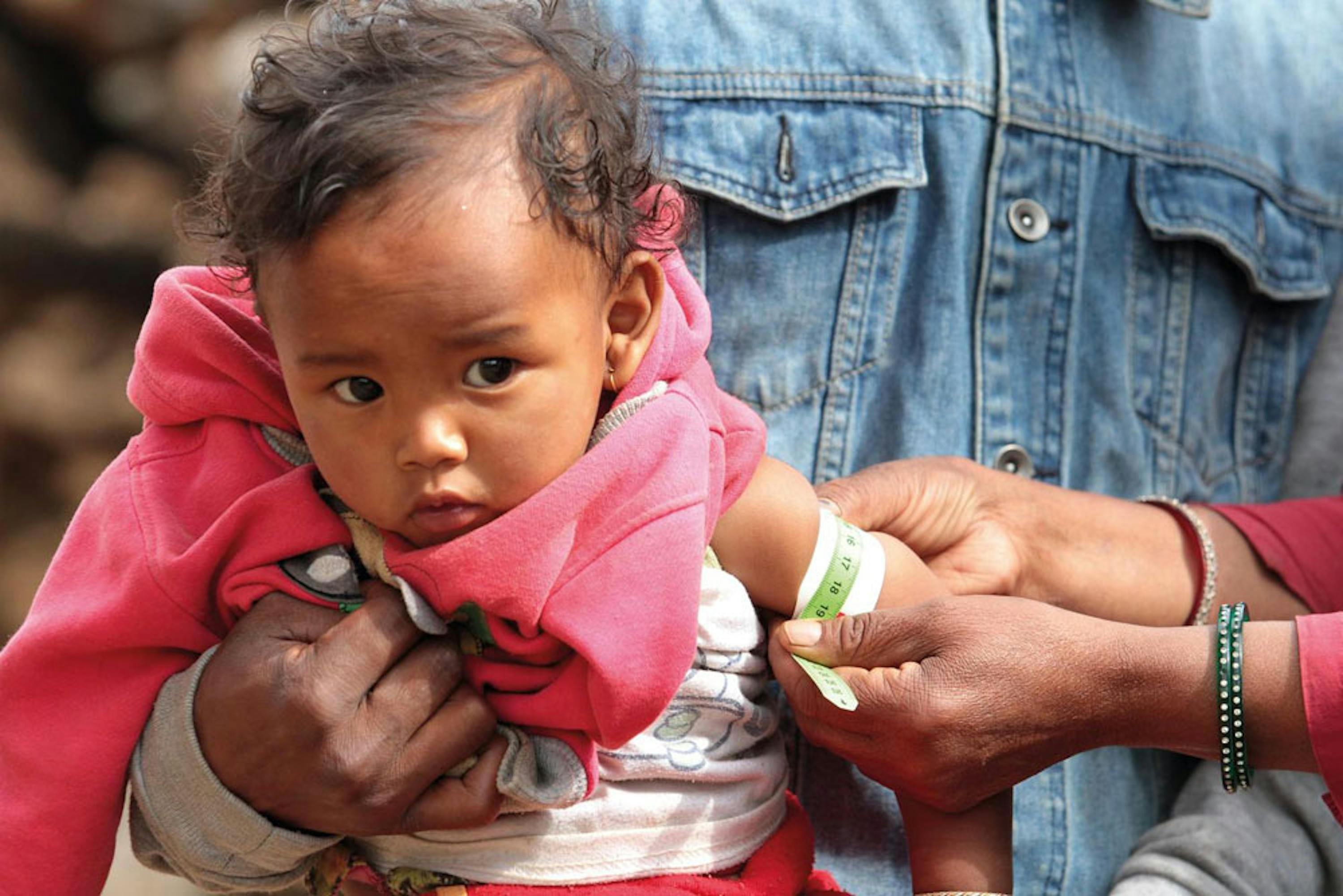 La misurazione della circonferenza brachiale con il braccialetto MUAC serve per determinare lo stato nutrizionale. Bhimeshwar (Nepal) - ©UNICEF/PFPG2015-3055/Panday