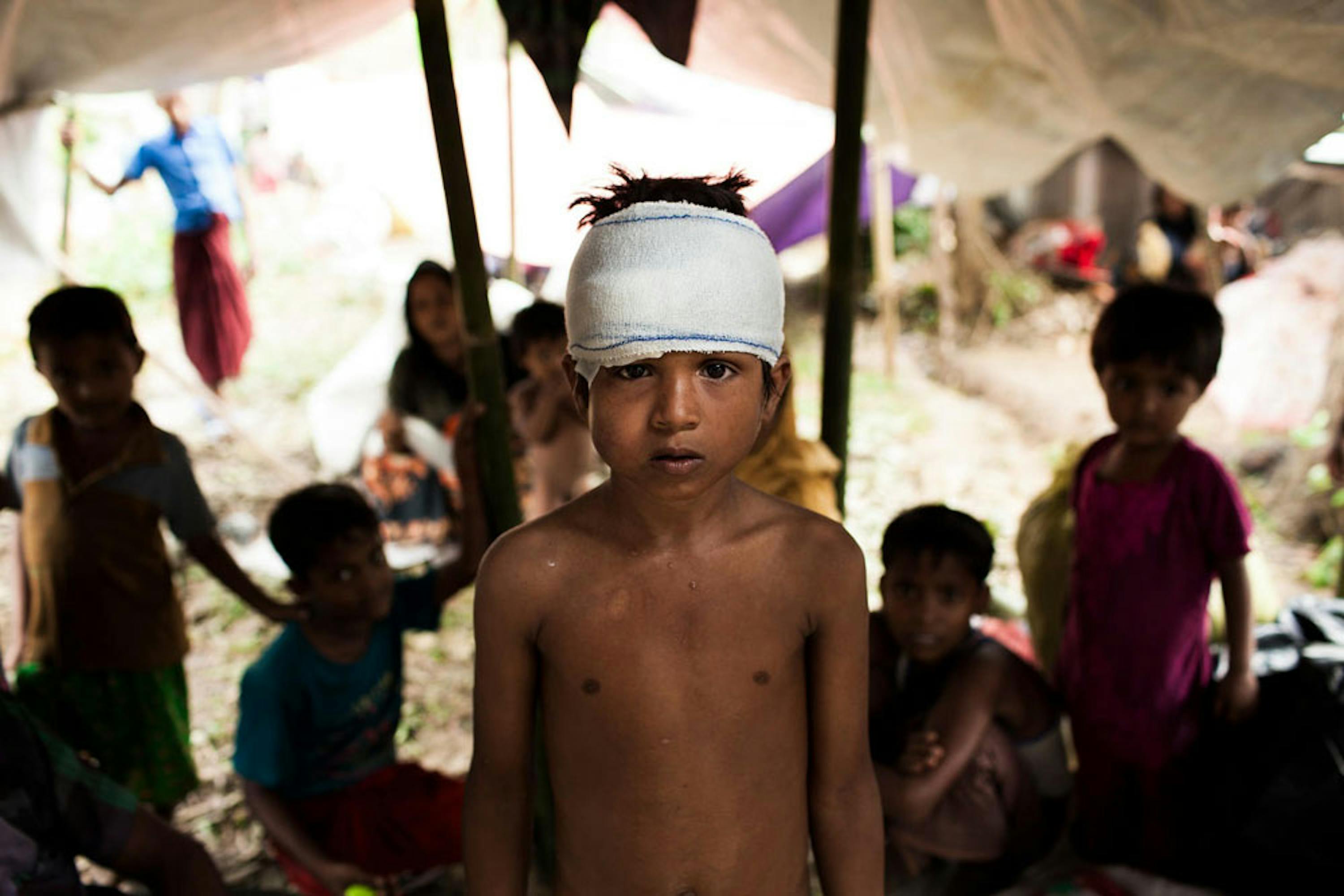 Mohammed, 8 anni, uno dei tantissimi bambini Rohingya arrivati bisognosi di cure mediche in Bangladesh - ©UNICEF/UN0119119/Brown