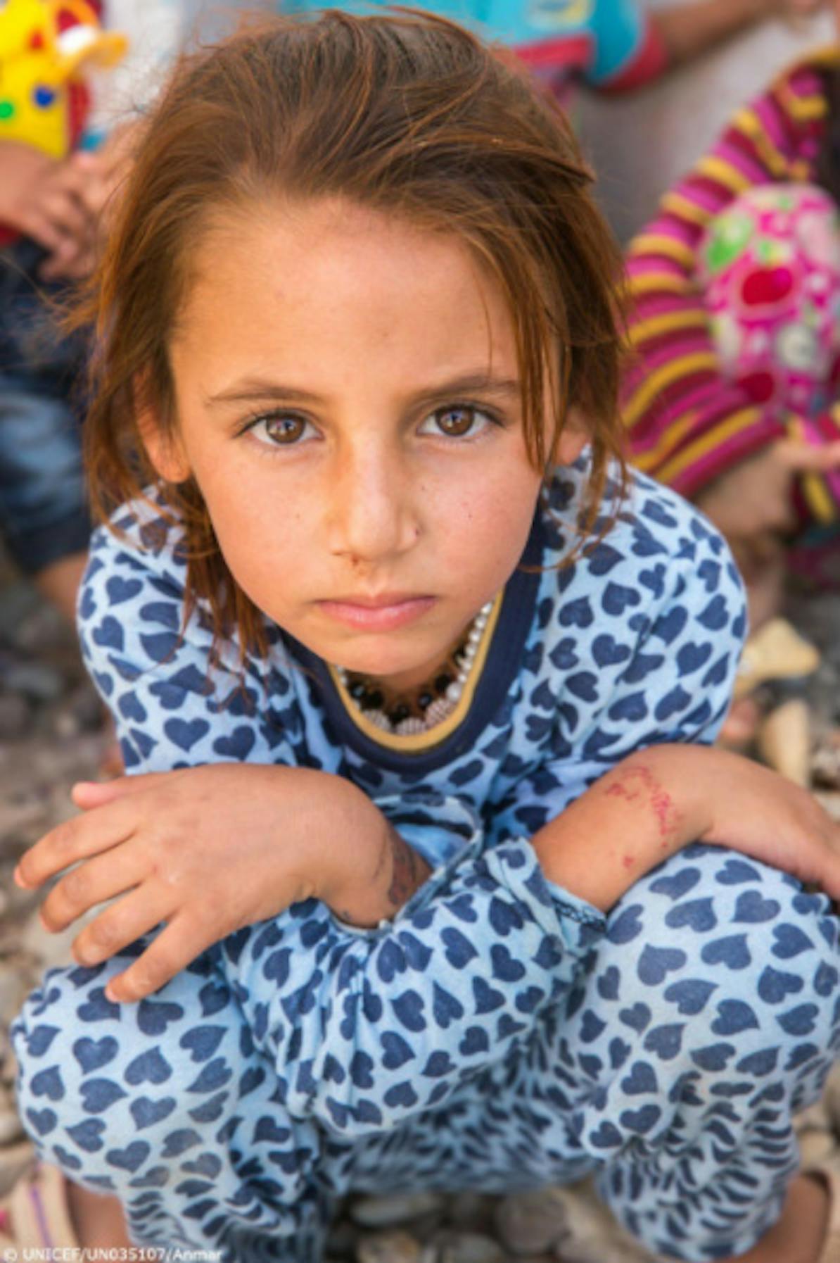 Noor, una bambina che vive in un campo per sfollati nel nord dell’Iraq - ©UNICEF Iraq/2018