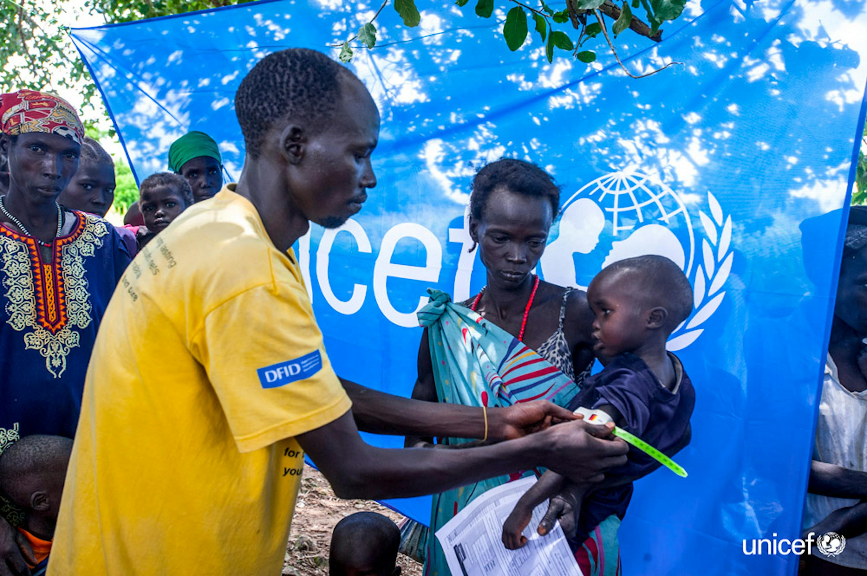 Sud Sudan - Un operatore sanitario misura la circonferenza  del braccio a un bambino malnutrito con uno strumento atropometrico - © UNICEF/UN034403/Rich