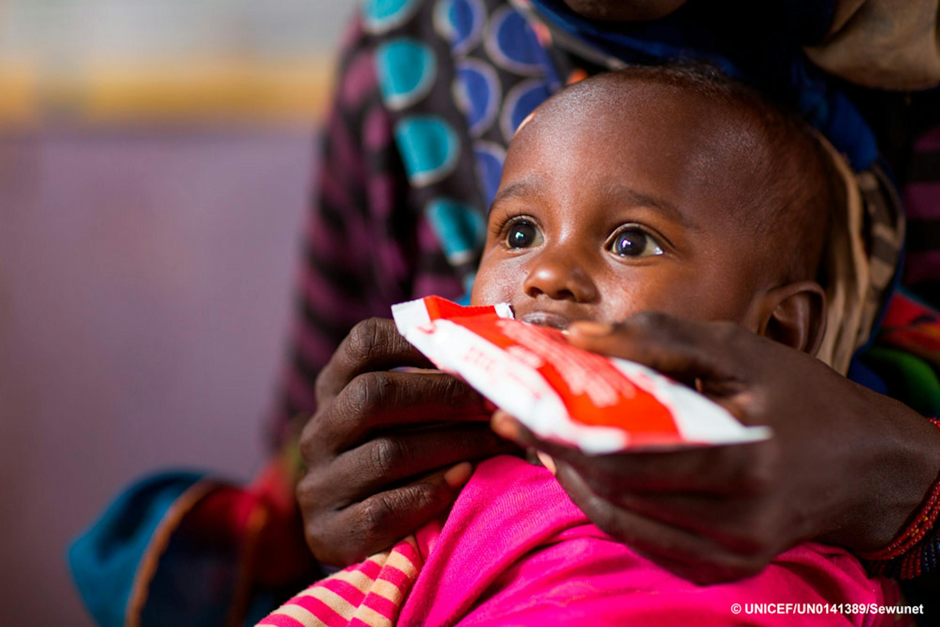  65/5000 Gemechu Teteche, 2 anni, si nutre di cibo terapeutico in Etiopia.