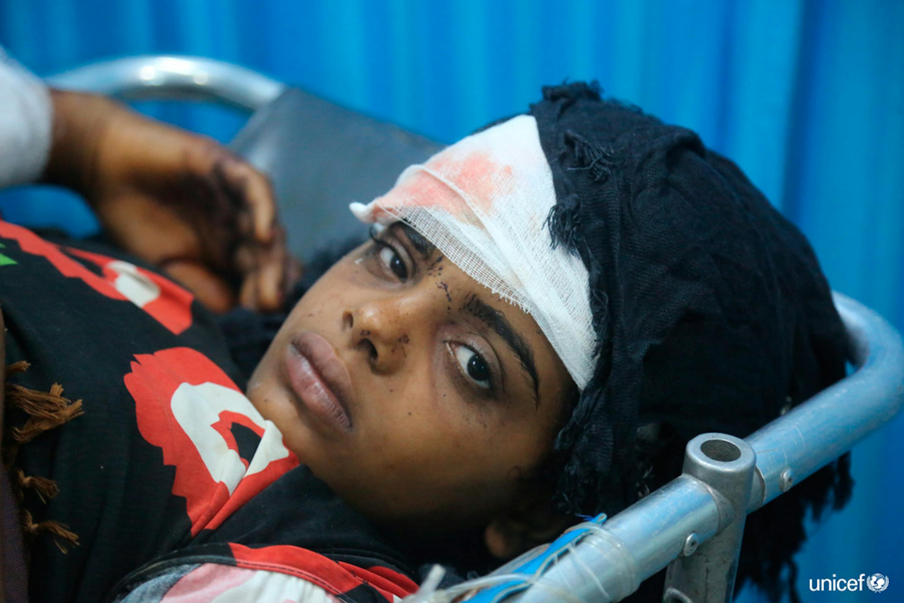 Yemen, una ragazza ferita viene curata all'ospedale Al Thawra di Hodeidah - © UNICEF/UN0216979/Ayyashi