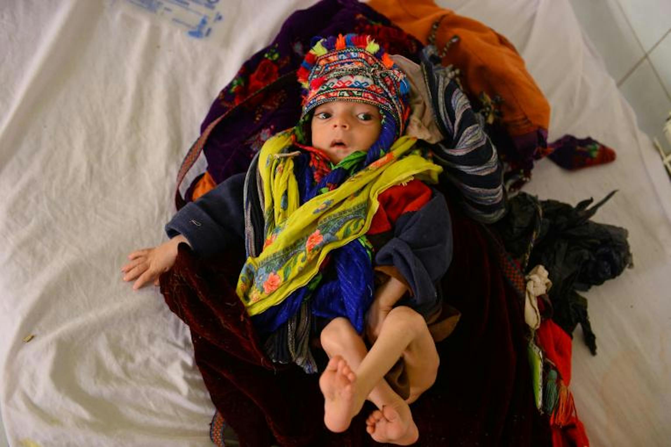 © UNICEF/UN0280720/Hashimi AFP-Services