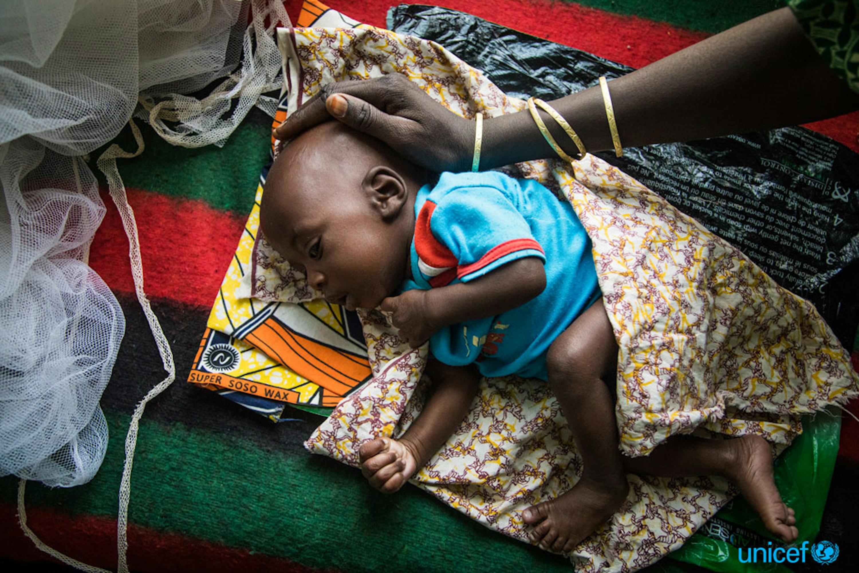 Una donna accarezza la testa del suo bambino che dorme malnutrito al centro materno e infantile della città di Diffa, in Niger -   © UNICEF/UN055334/Tremeau