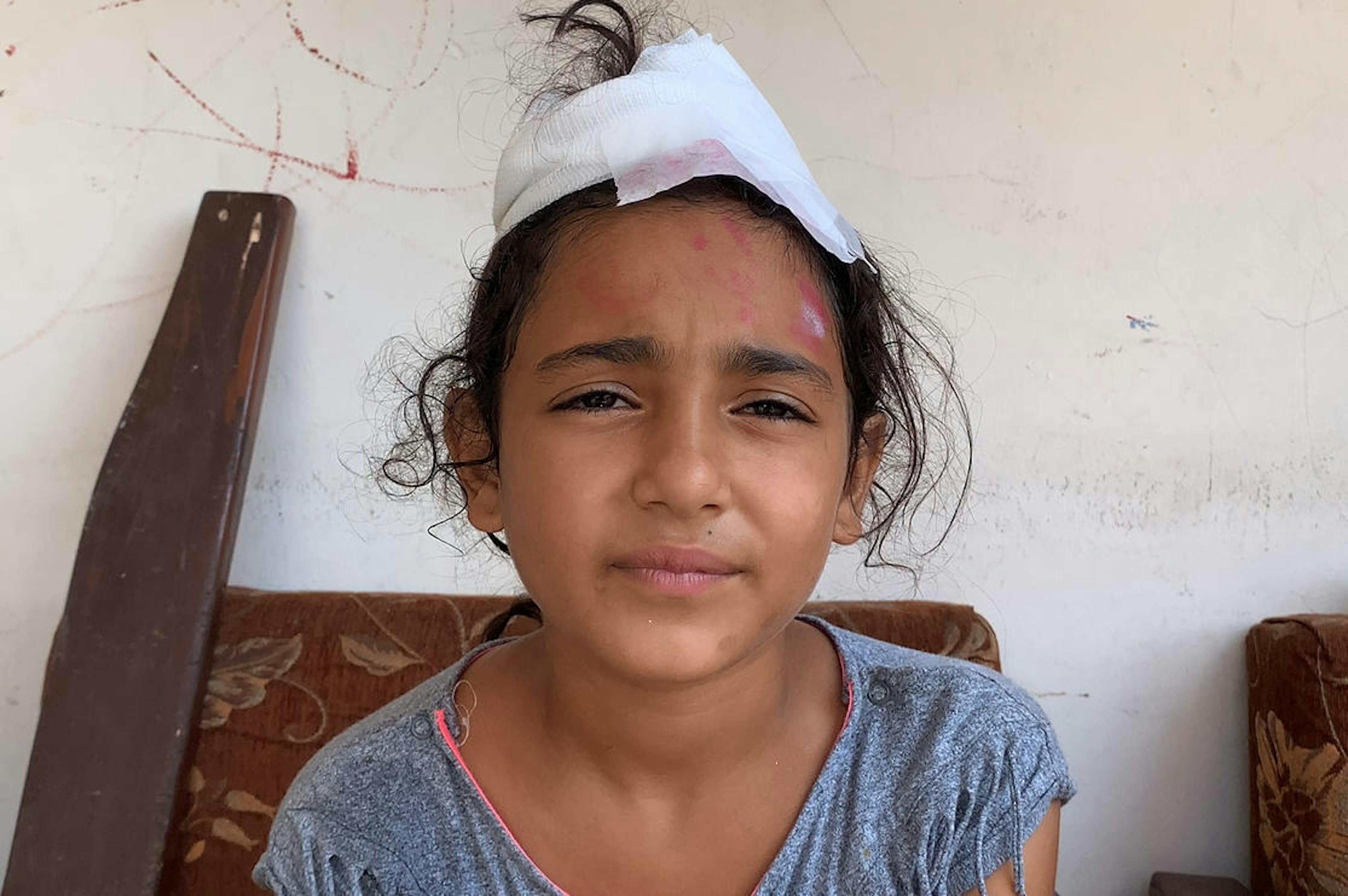 Mira, 10 anni, è rimasta ferita alla testa mentre si trovava nella sua abitazione a Beirut (Libano), il giorno della terribile esplosione nel porto - ©UNICEF/UNI360451/El Hage