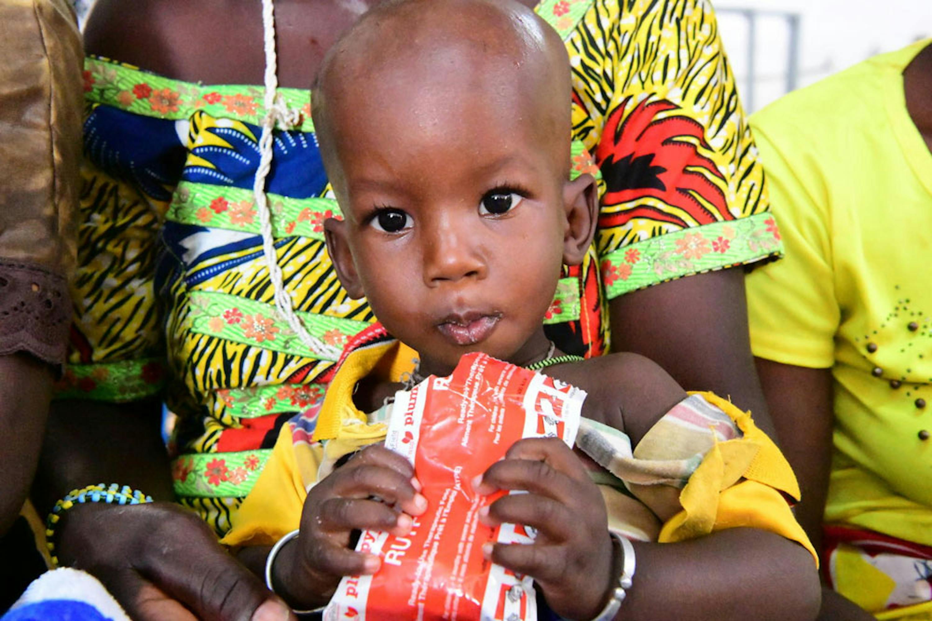 Una bambina affetta da malnutrizione consuma una dose di Plumpy'Nut, un alimento terapeutico pronto per l'uso, in un centro nutrizionale di Kaya (Burkina Faso) - © UNICEF/UNI394870/DeJongh