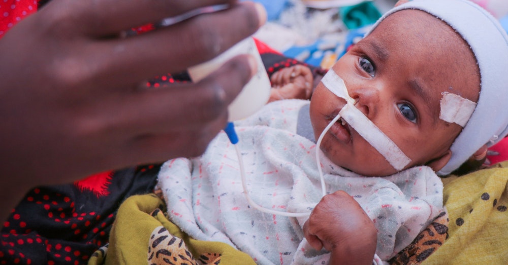 Yemen, tassi di malnutrizione più alti mai registrati UNICEF Italia