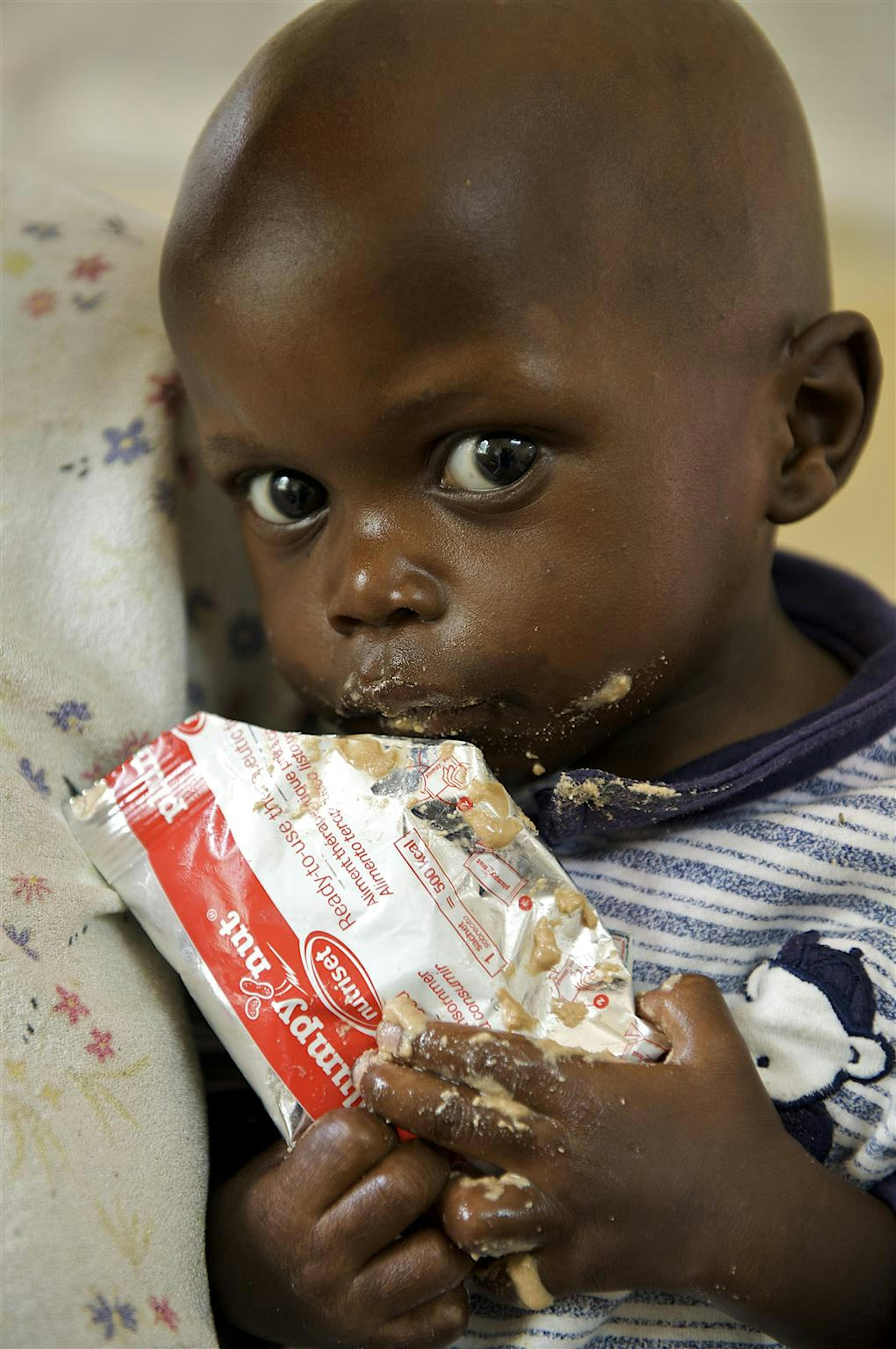 Un bambino con una razione di Plumpynut, alimento terapeutico pronto per l'uso, nel reparto per malnutriti gravi dell'ospedale di Arua (Uganda) - ©UNICEF/HQ2010-1521/S.Noorani