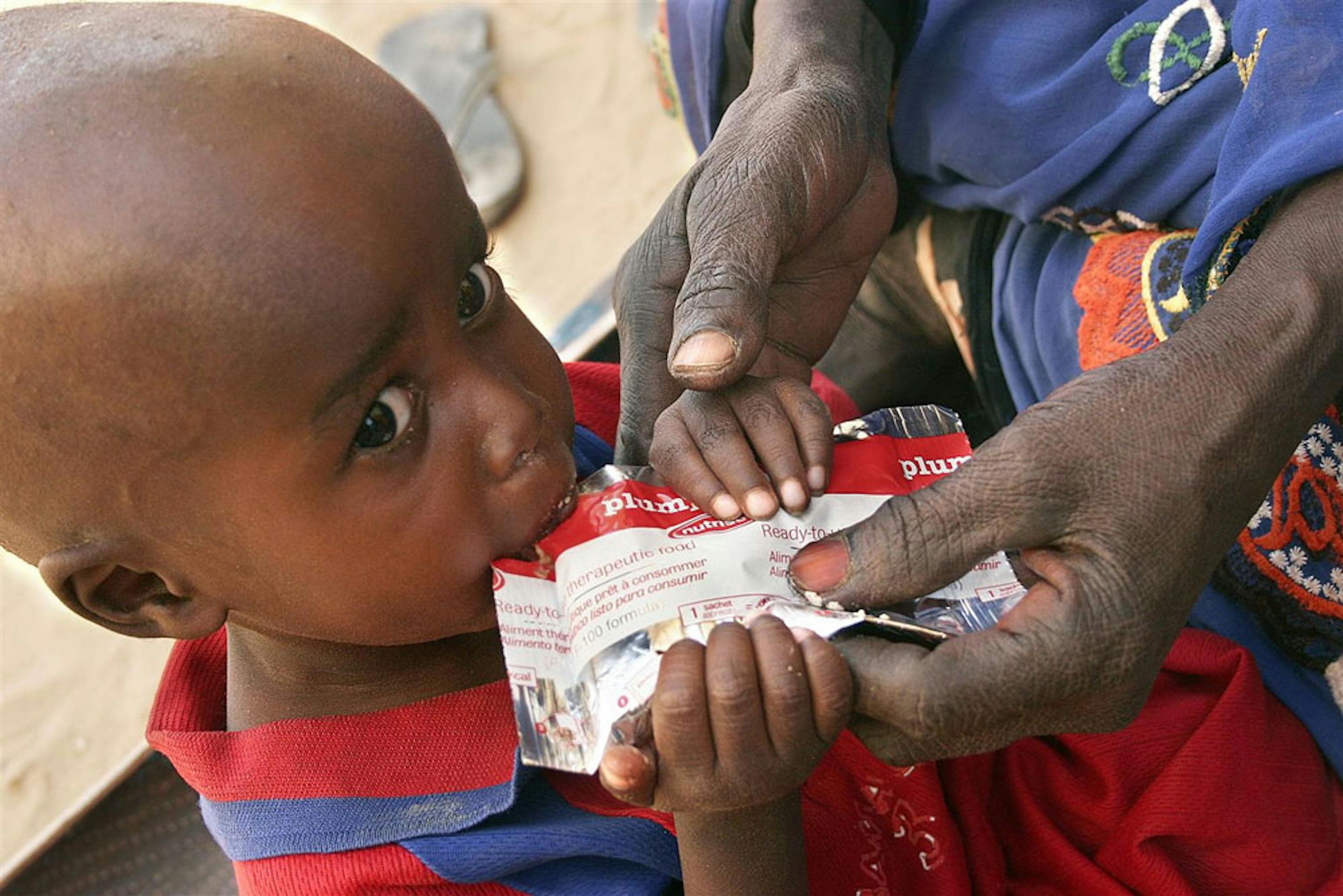 Un bambino affetto da una grave forma di malnutrizione viene alimentato con il PlumpyNut nel villaggio di Mao, nel Ciad occidentale - ©UNICEF/UNI84860/Gian Paolo Porcu