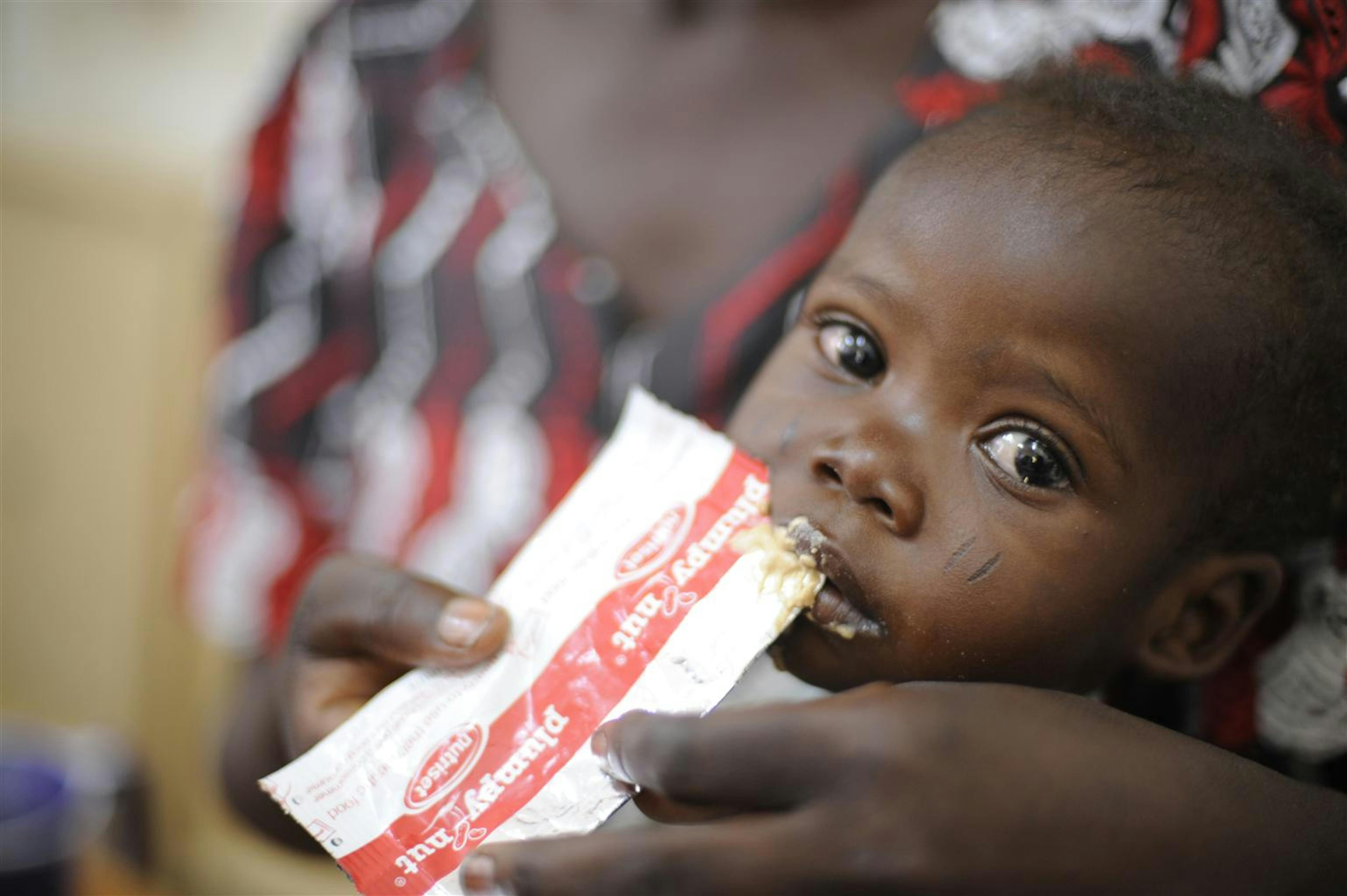 Un bambino ormai in fase di recupero da uno stadio di malnutrizione acuta nel centro nutrizionale terapeutico Chagoua a N'Djamena, capitale del Ciad - ©UNICEF/NYHQ2010-1159/R.Gangale 