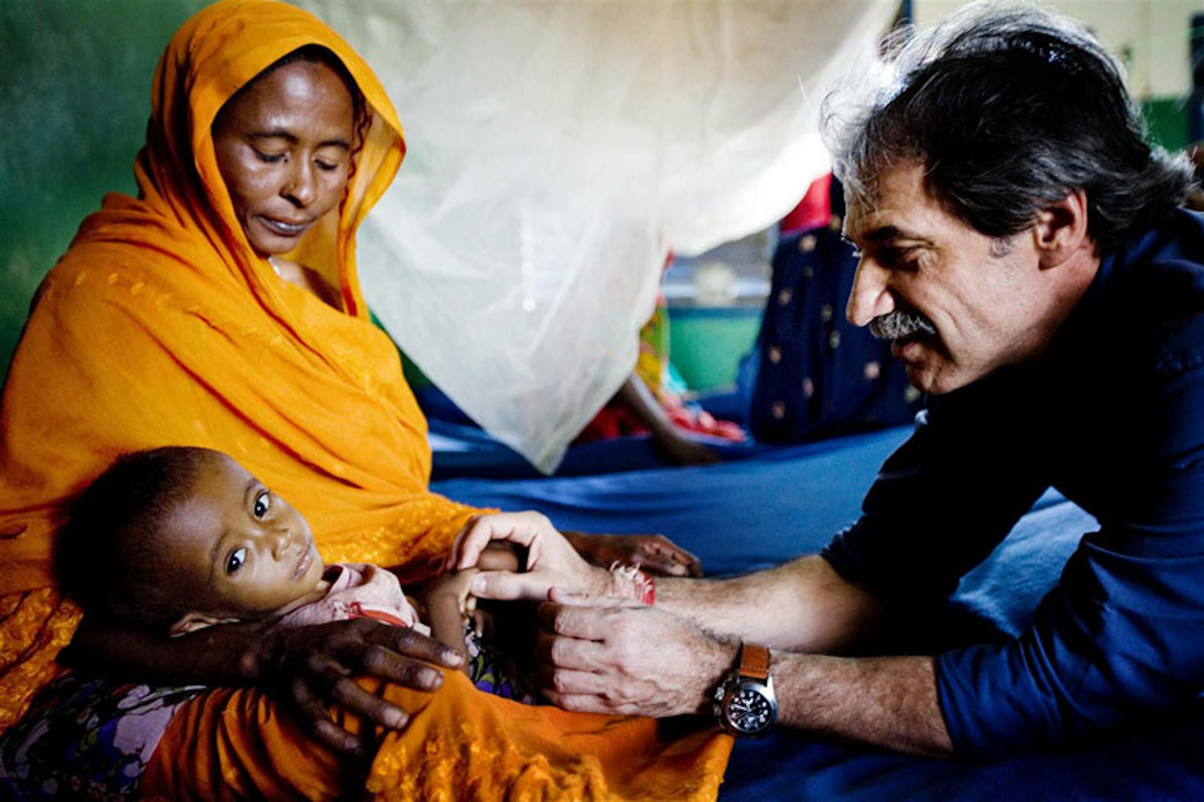 Marzio Babille (pediatra italiano dell'UNICEF) visita un bambino gravemente malnutrito in un ambulatorio in Ciad - ©UNICEF/NYHQ2010-0401/K.Holt
