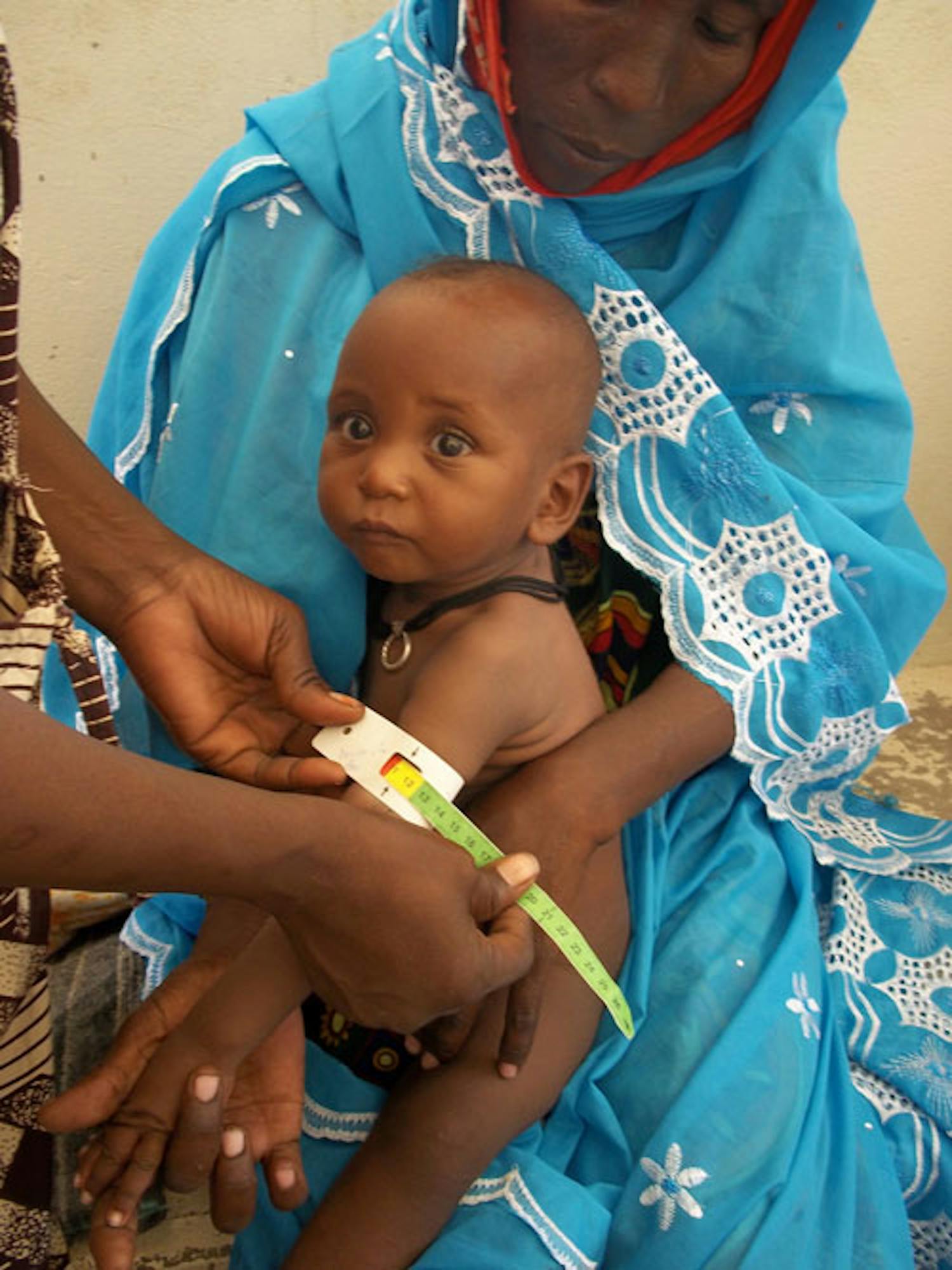 A questo bambino, in braccio alla mamma, viene misurata la circonferenza del braccio come indicatore della malnutrizione. ©Saira Cutrone