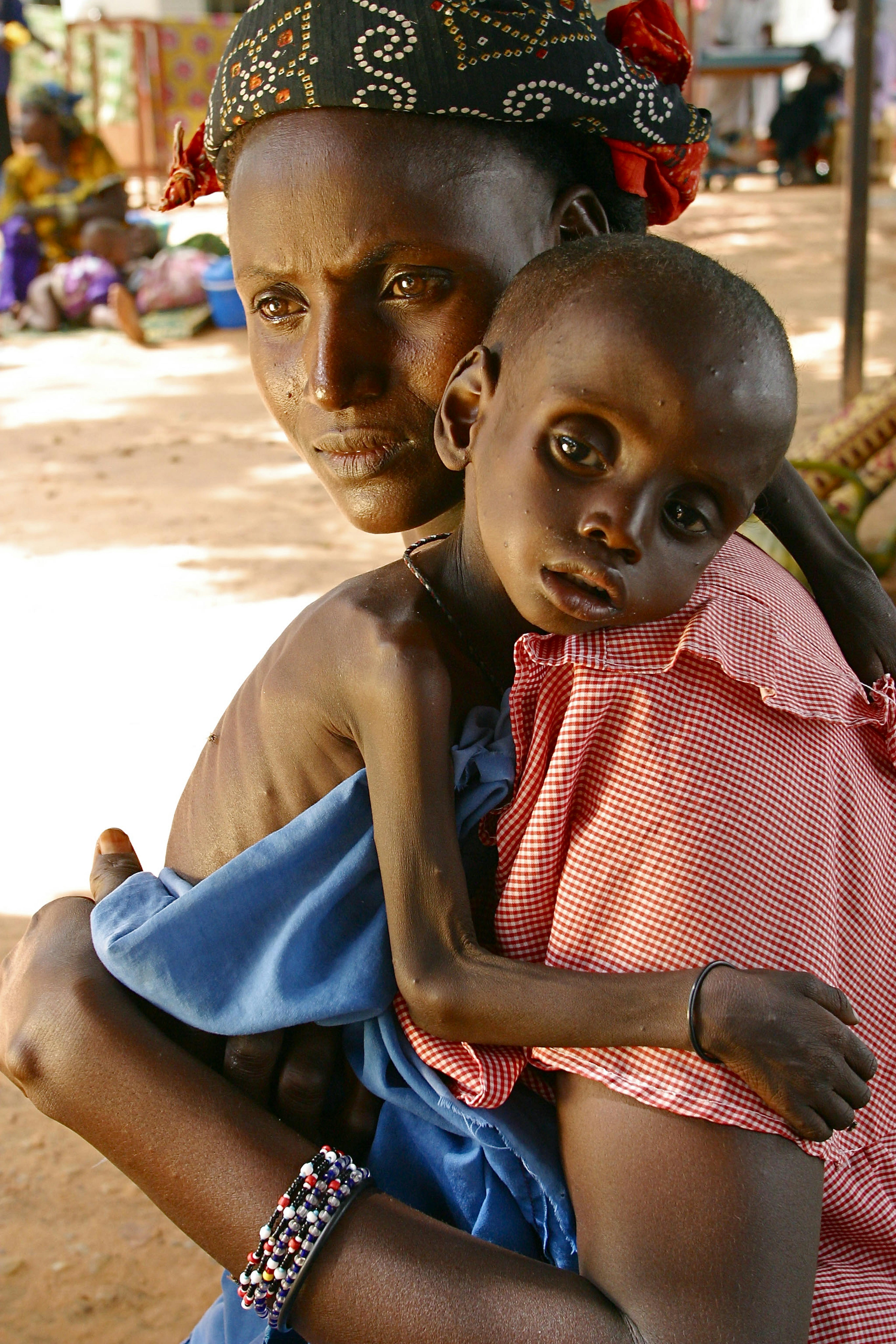 In Africa occidentale è emergenza malnutrizione. Qui l'UNICEF sta intervenendo con la distribuzione di terapie alimentari a base di Plumpynut ©UNICEF/NTHQ2005/2436/Pirozzi