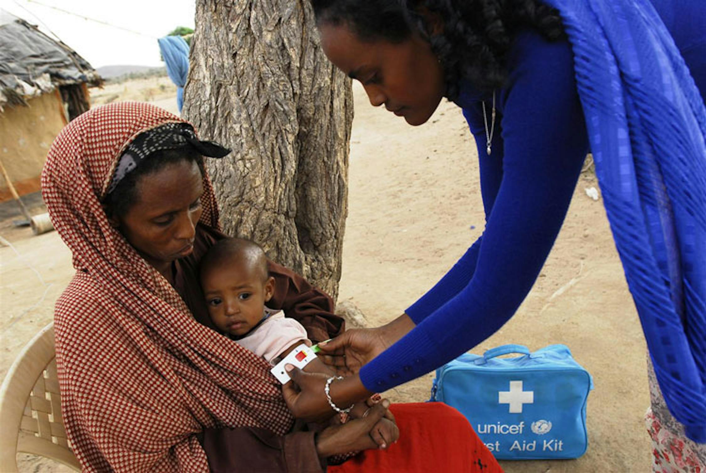 Meleb (Etiopia): un'operatrice misura lo stato di malnutrizione della piccola Firdoze, 10 mesi, utilizzando l'apposito braccialetto denominato MUAC - ©UNICEF/NYHQ2011-1329/Getachew 