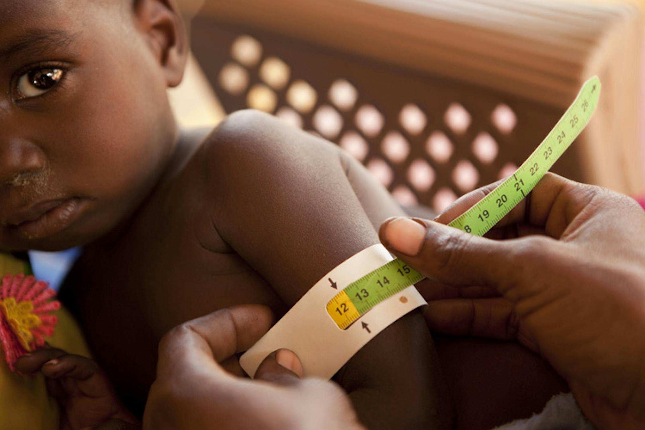 Un operatore misura la circonferenza del braccio di un bambino nel Centro per sfollati di Koubigou (Ciad): il colore giallo identifica uno stato di malnutrizione - ©UNICEF/NYHQ2011-2139/P.Esteve