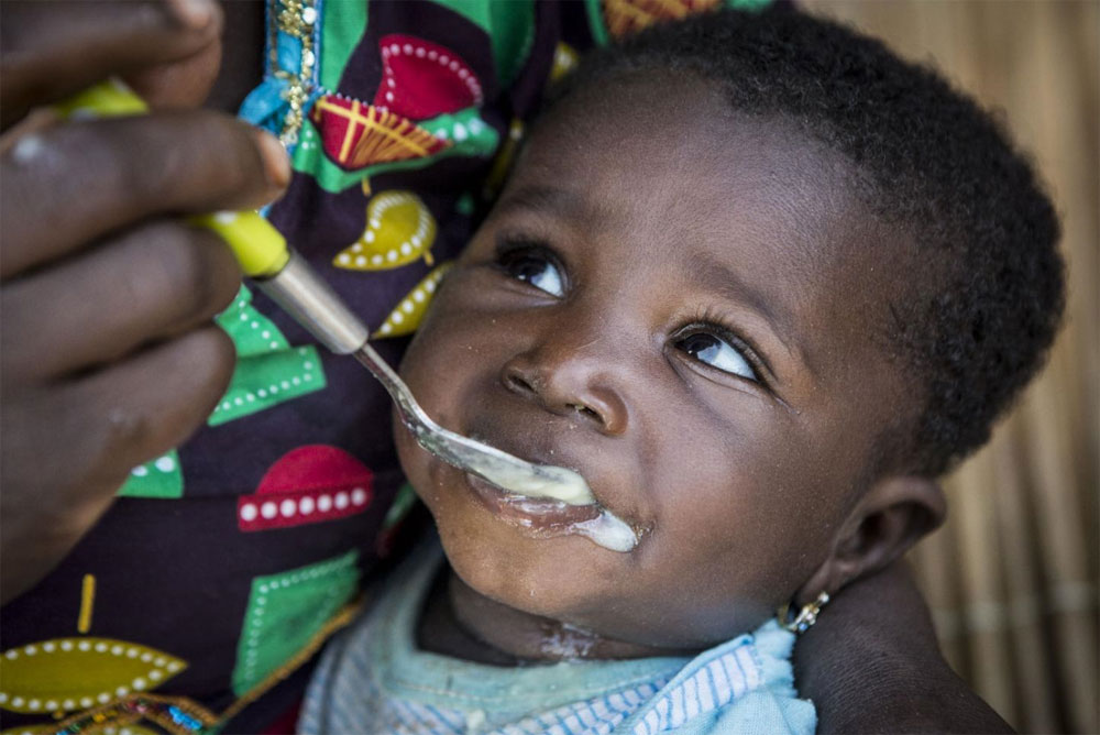 Gli effetti della malnutrizione sull'infanzia UNICEF Italia