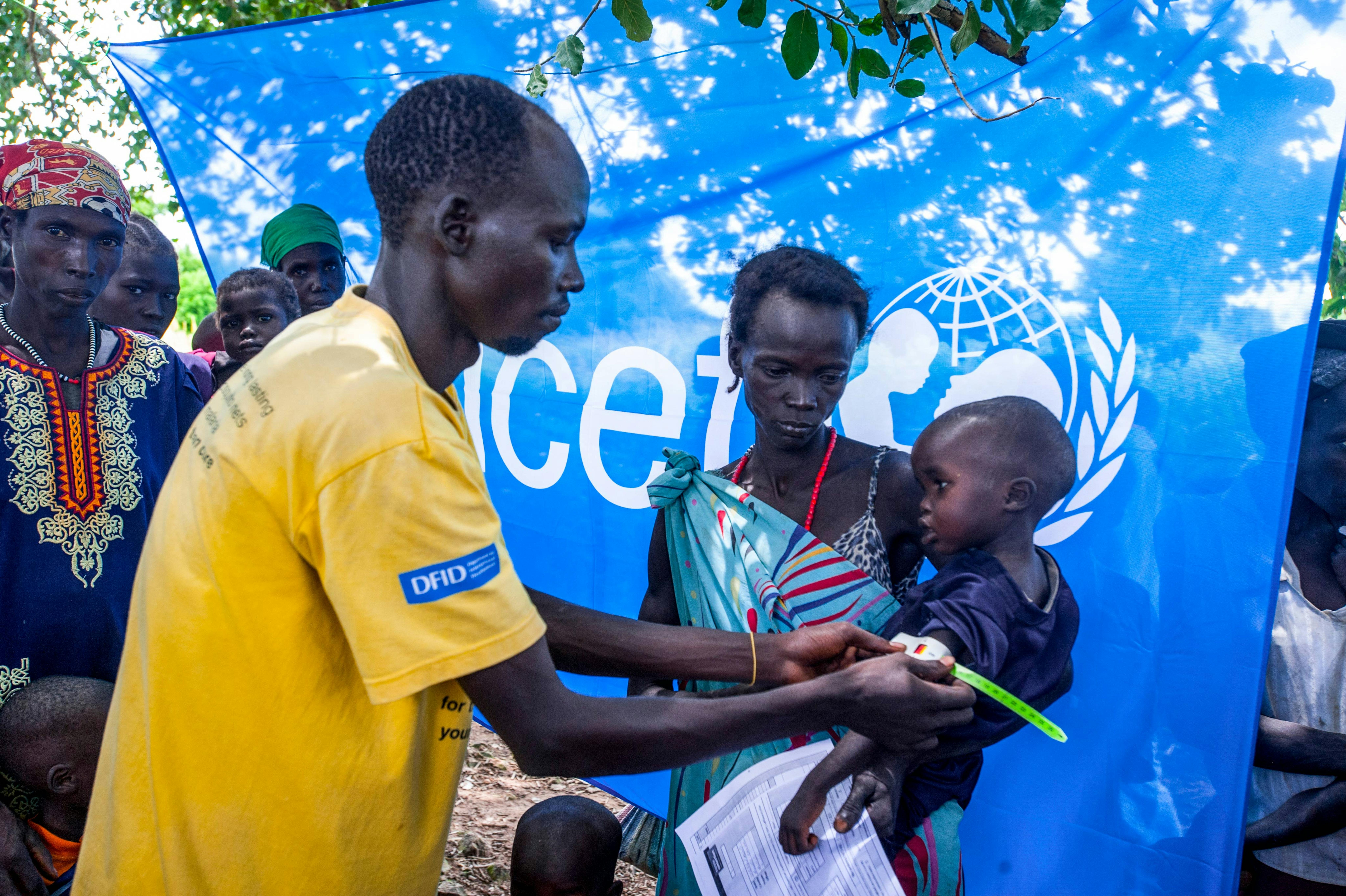 Un bambino viene sottoposto a screening per la malnutrizione in un centro sanitario sostenuto dall'UNICEF ad Aweil, nel Sud Sudan.