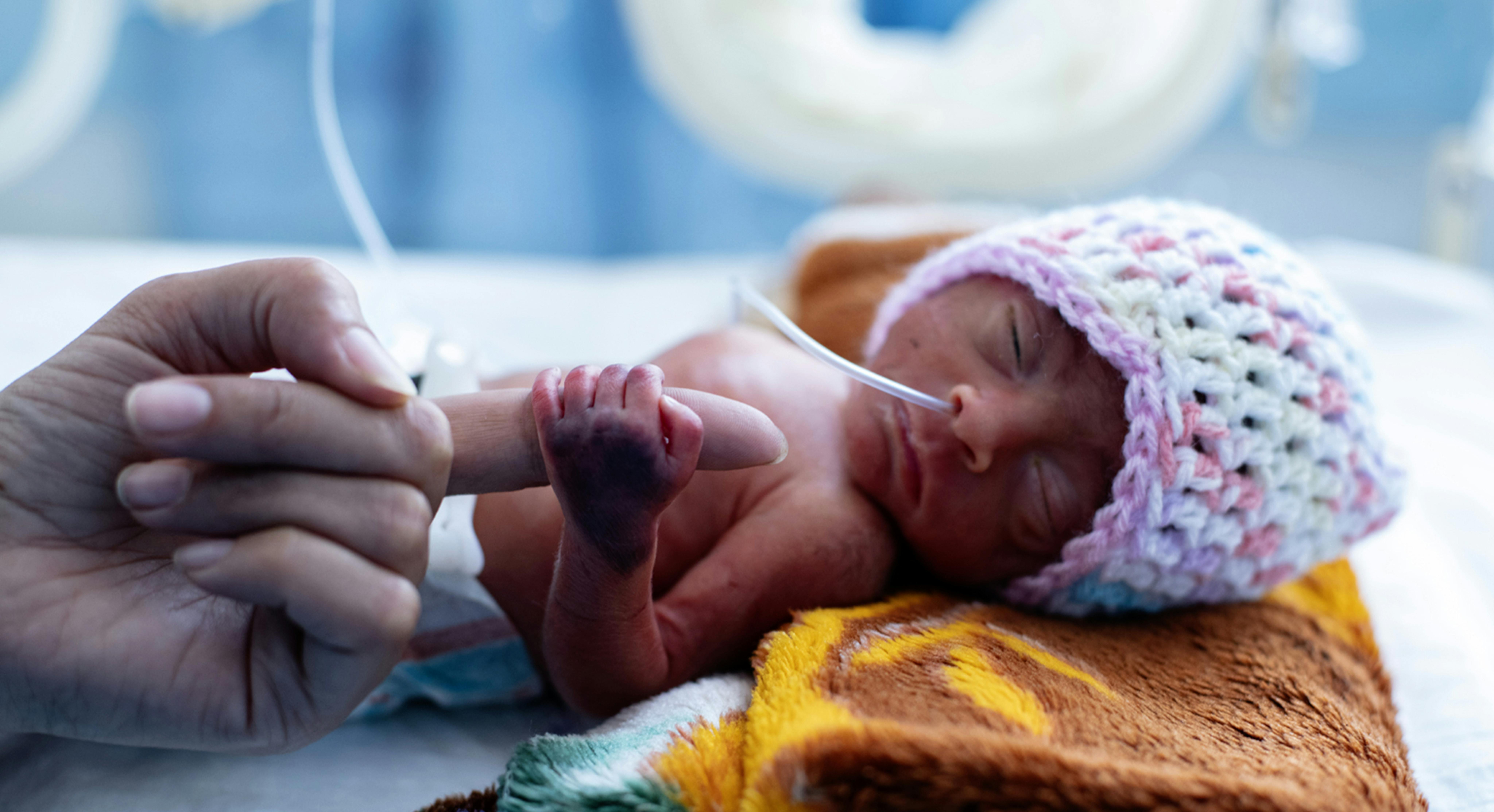 neonato-yemen