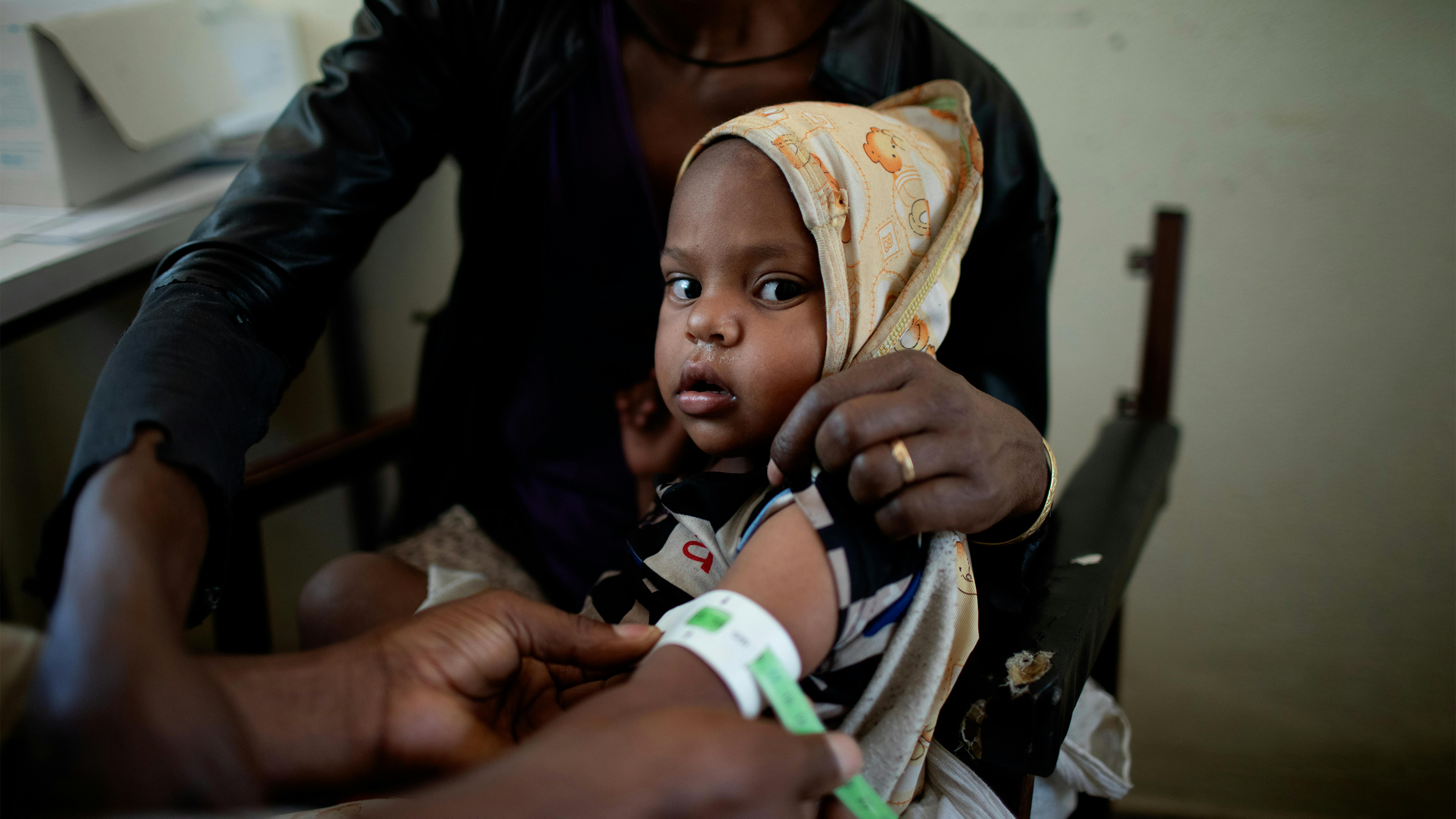 Etiopia, un bambino viene aottoposto allo screening per la malnutrizione
