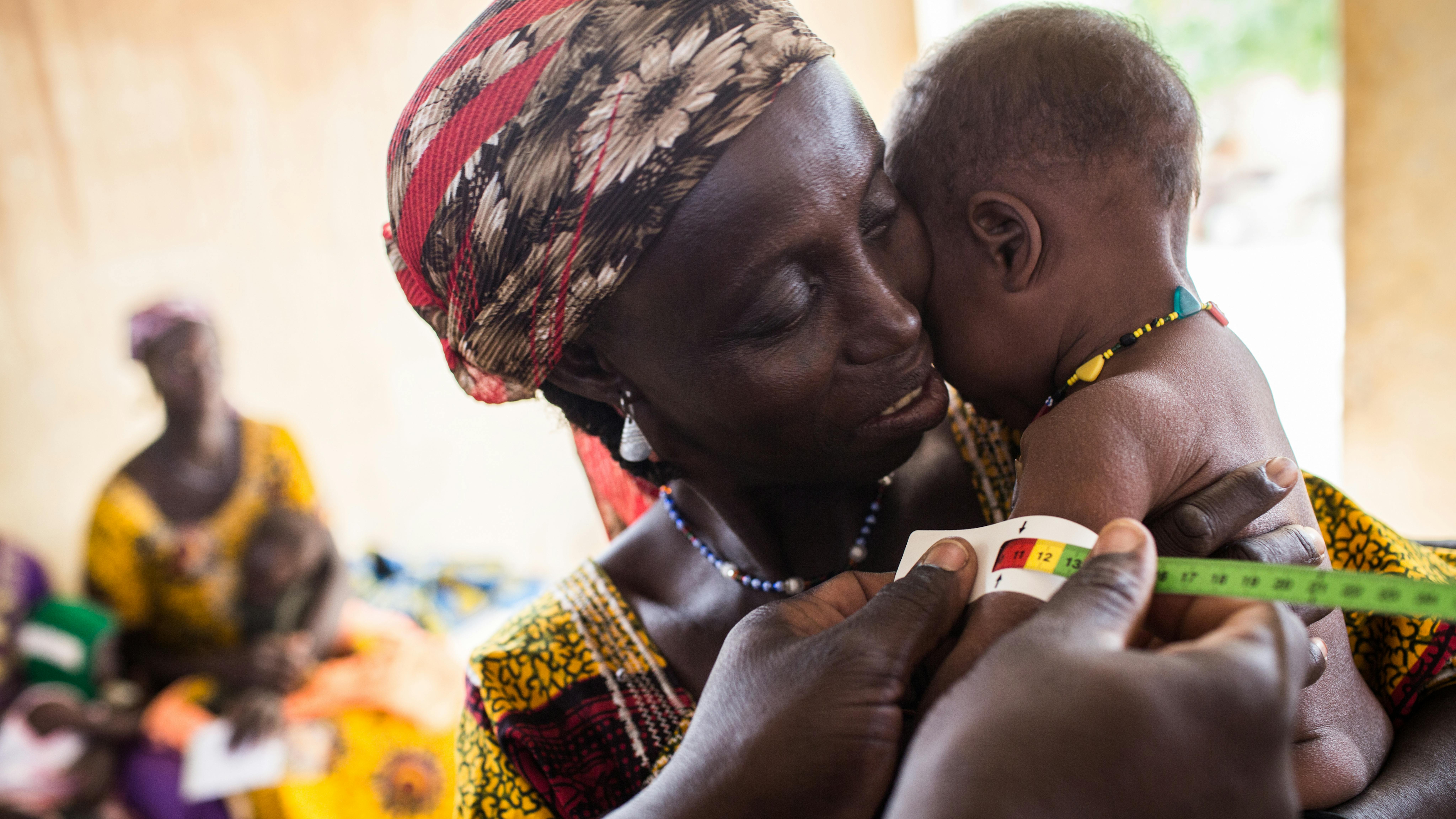 Niger, Centro sanitario di Bembey, la circonferenza del braccio della bambina di Acha Halilou indica che è malnutrita.