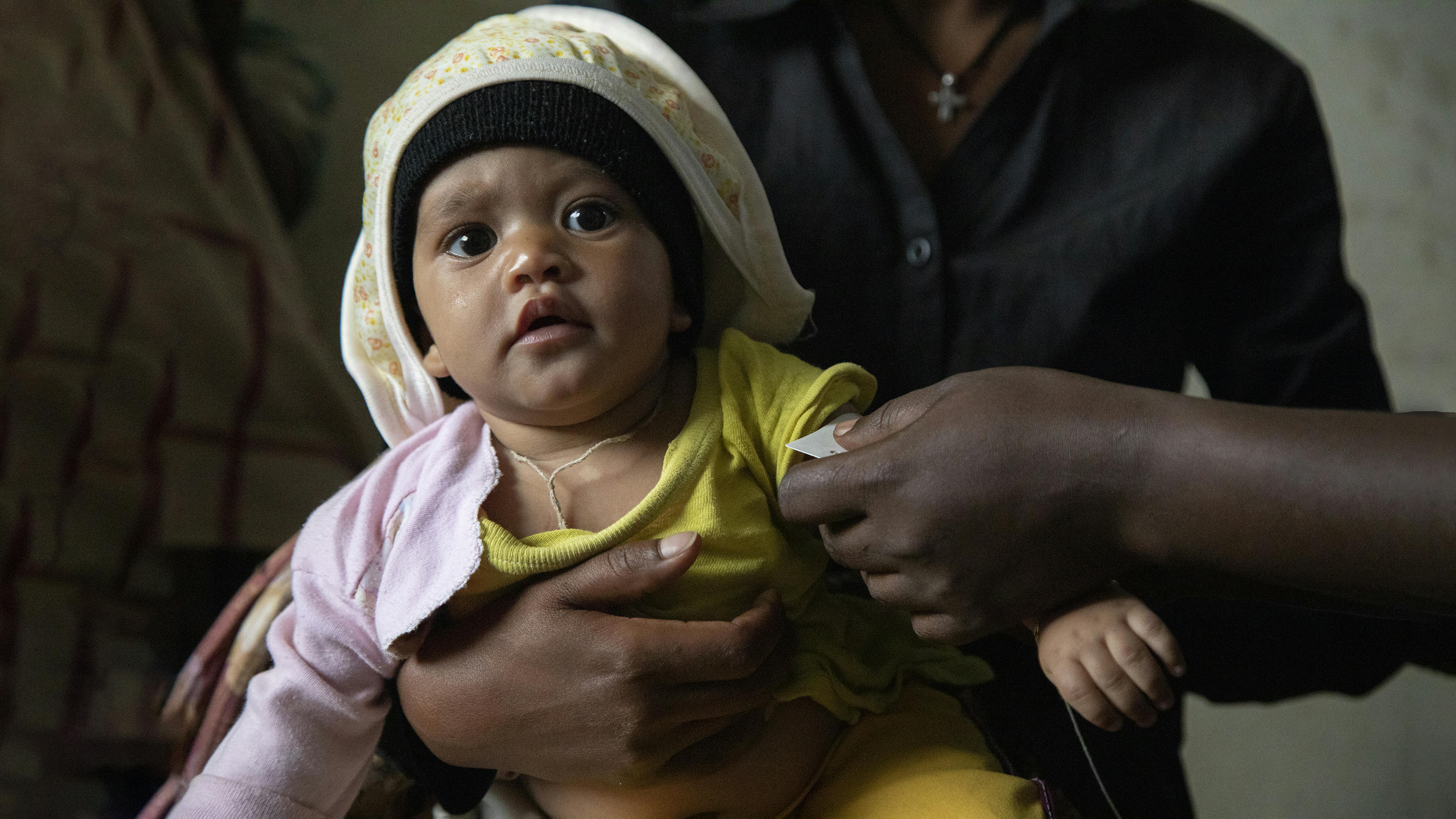 Un bambino viene visitato durante uno screening per la malnutrizione  a Gijet nella regione del Tigray in Etiopia