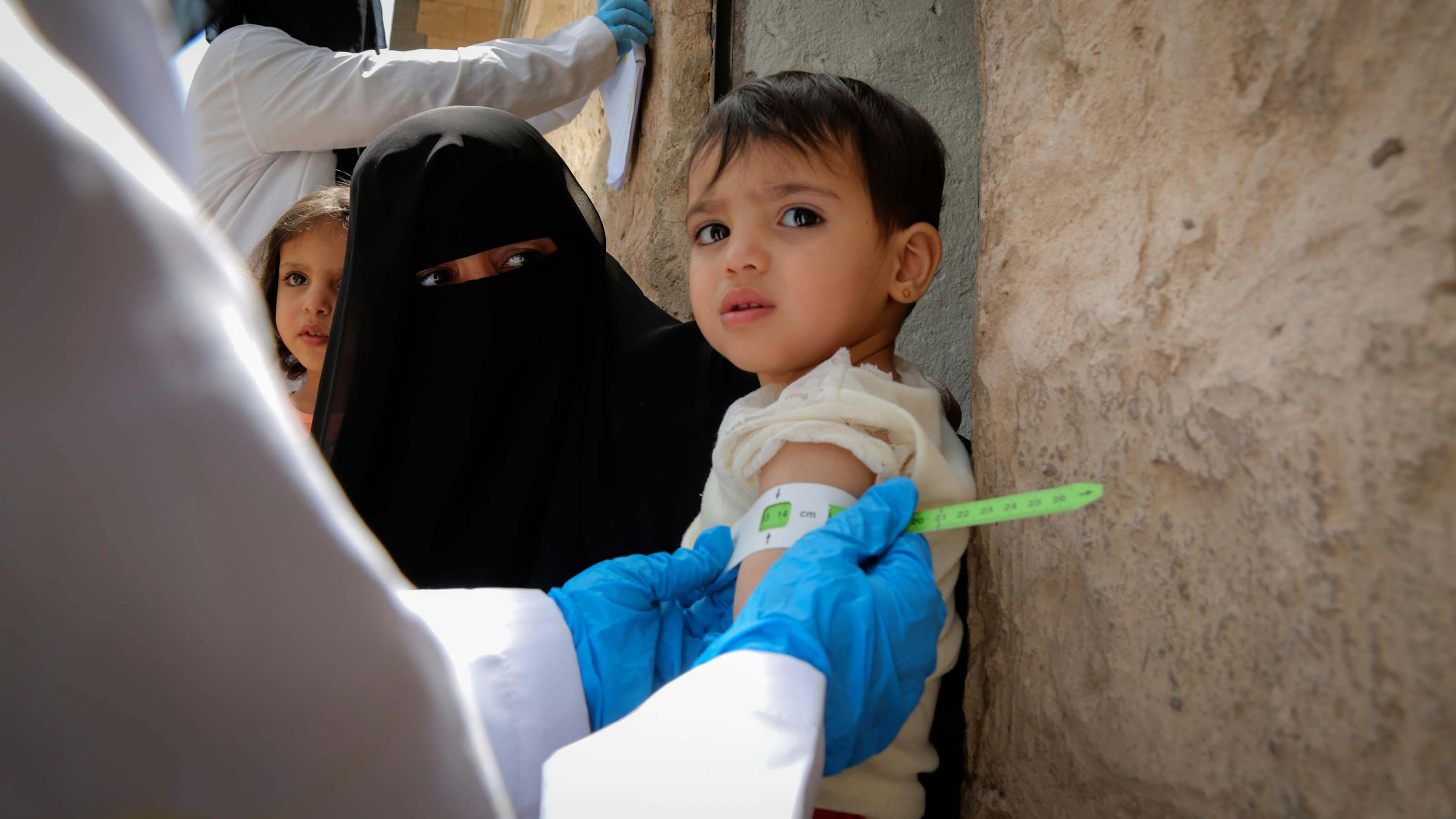 Yemen,  un  operatore sanitario volontario misura lo status della malnutrizione a un bambino