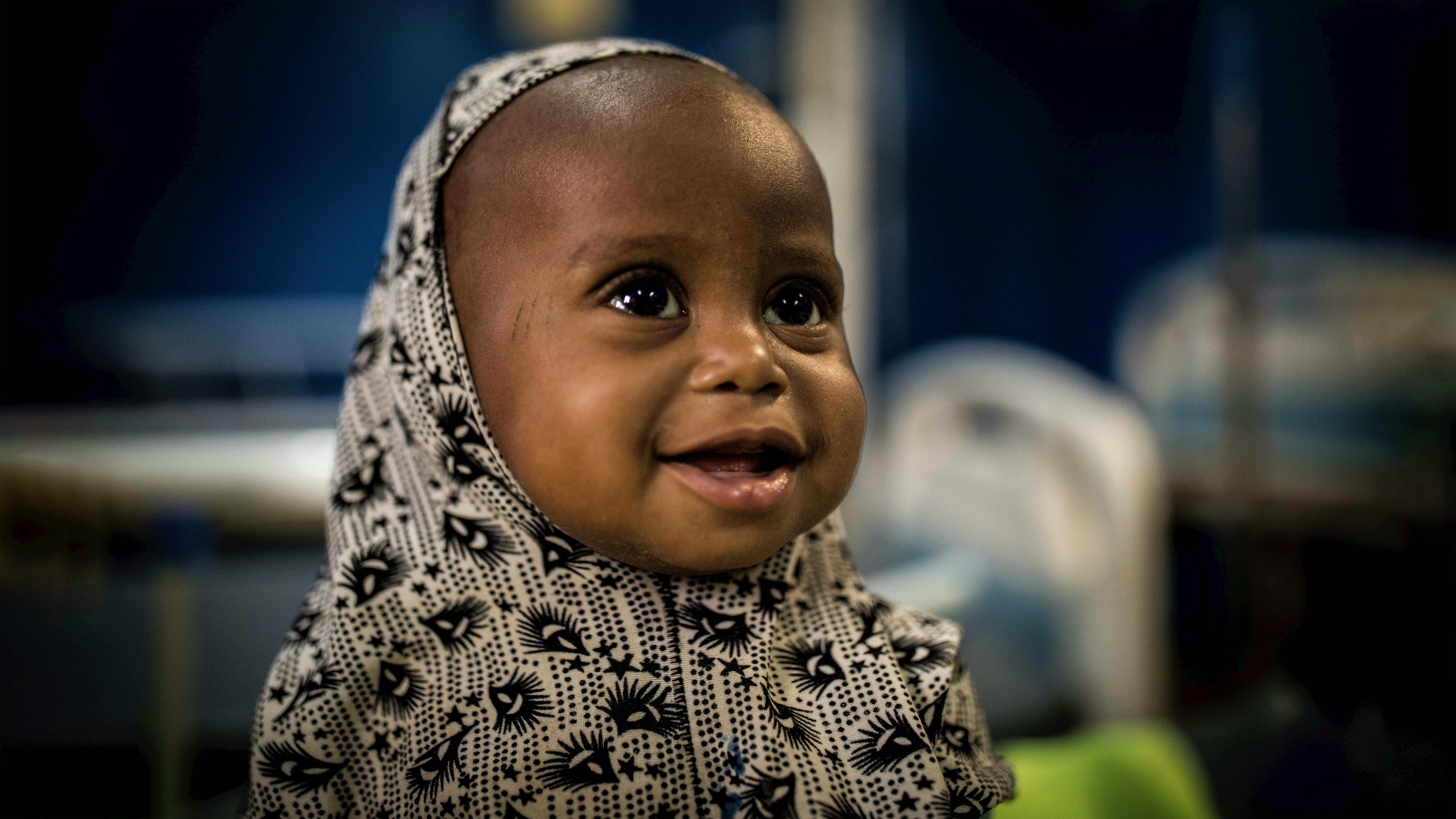 Mali - Maya Ag Oumar, 12 mesi, con una  grave malnutrizione acuta, è stata portata da sua madre all'ospedale di Timbuktu dopo aver percorso 135 chilometri dalla loro città 
