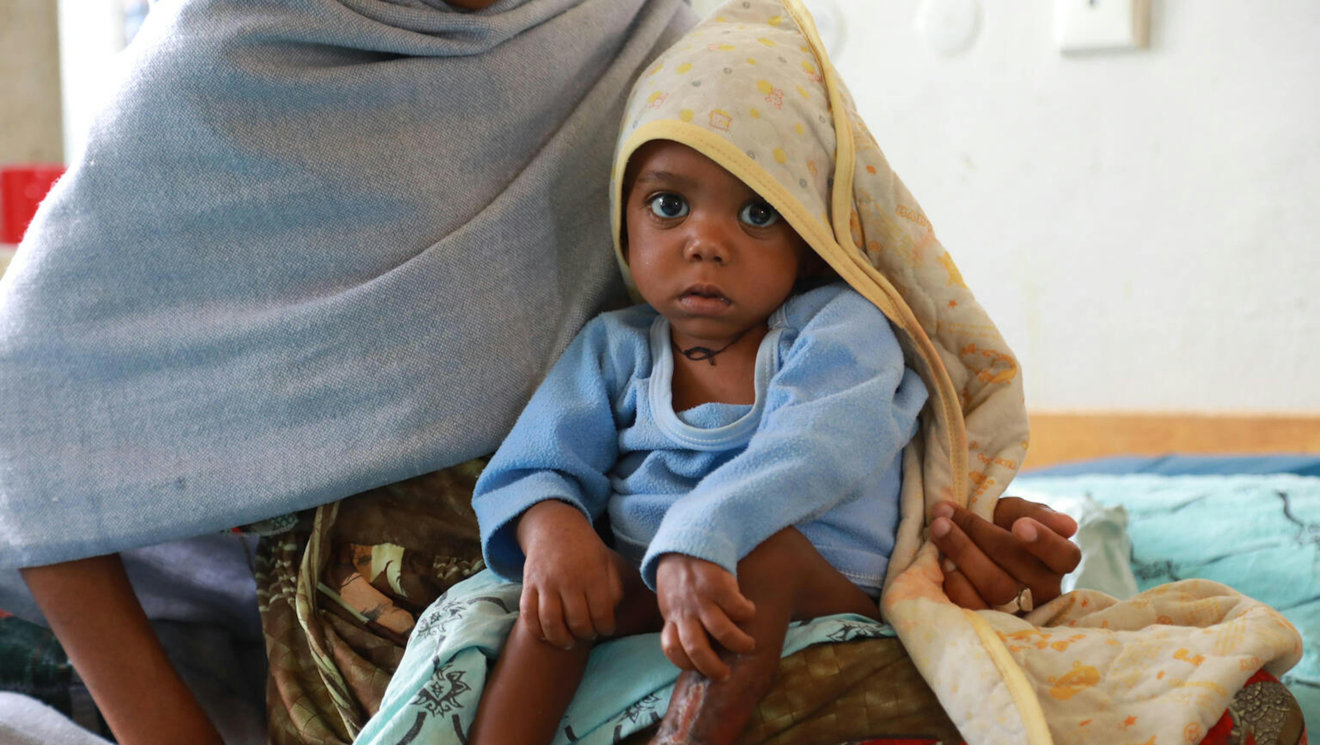 Una mamma si prende cura del suo bambino gravemente malnutrito in un'unità di stabilizzazione sostenuta dall'UNICEF nell'ospedale di Ayder a Mekelle, la capitale della regione del Tigray in Etiopia,.