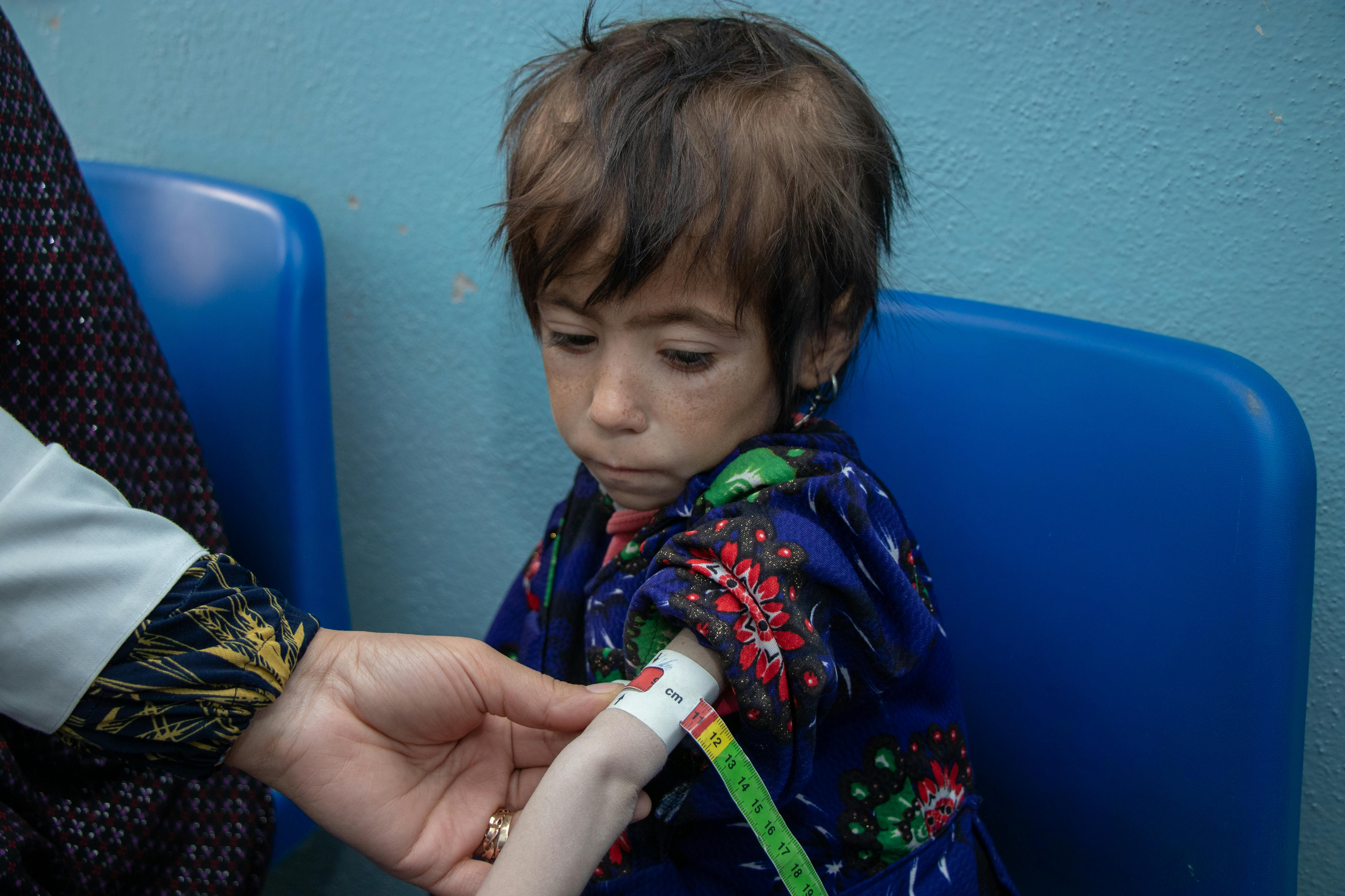 "Braccia sottili come un manico di scopa": la piccola Parwana, gravemente malnutrita, viene visitata in una clinica ad Herat. Il braccialetto utilizzato, MUAC, conferma lo stato di malnutrizione acuta grave