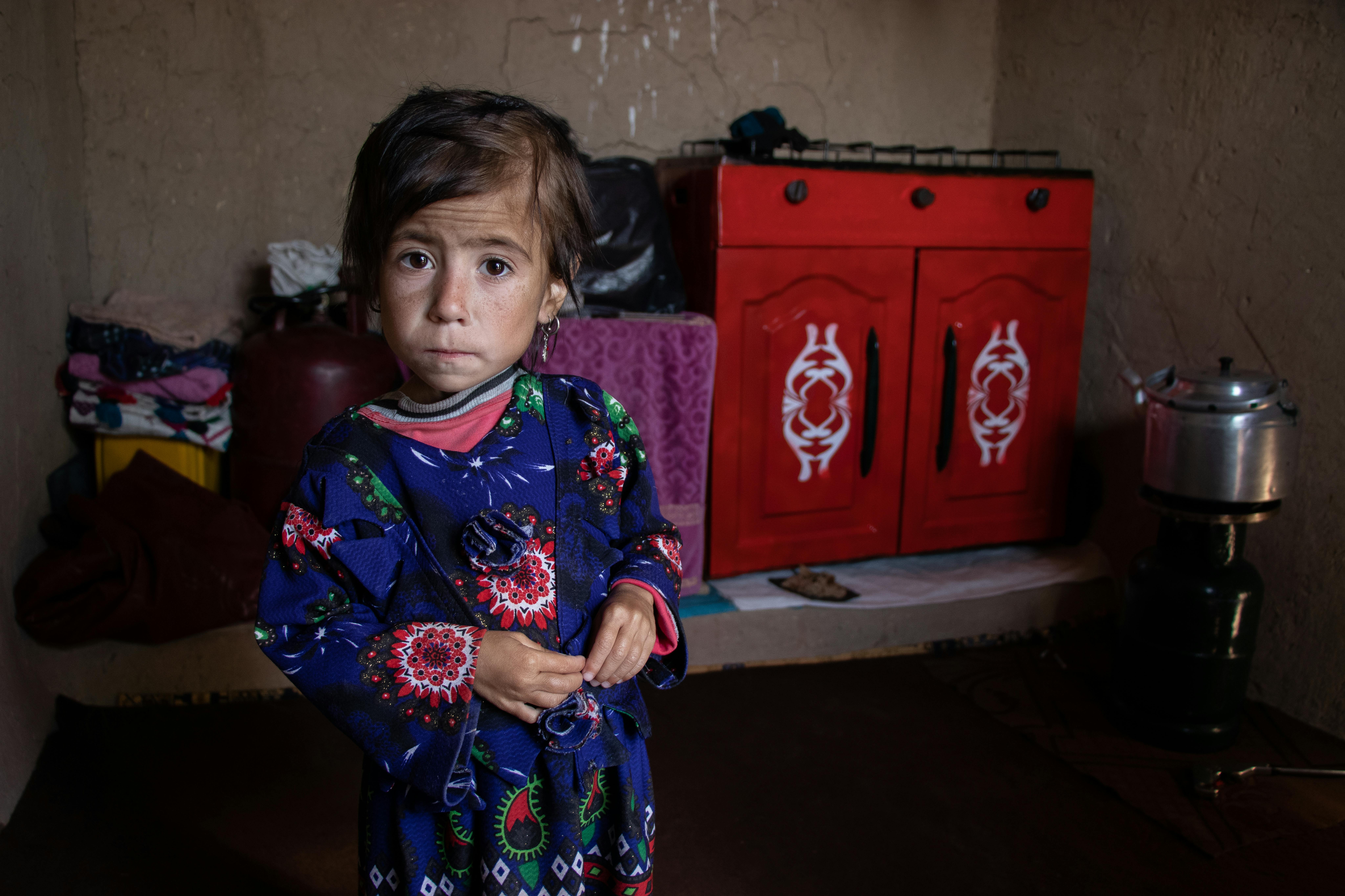 Parwana, 4 anni, si trova nel campo per sfollati interni di Shahrak-Sabz nella città di Herat, Afghanistan. E' gravemente malnutrita