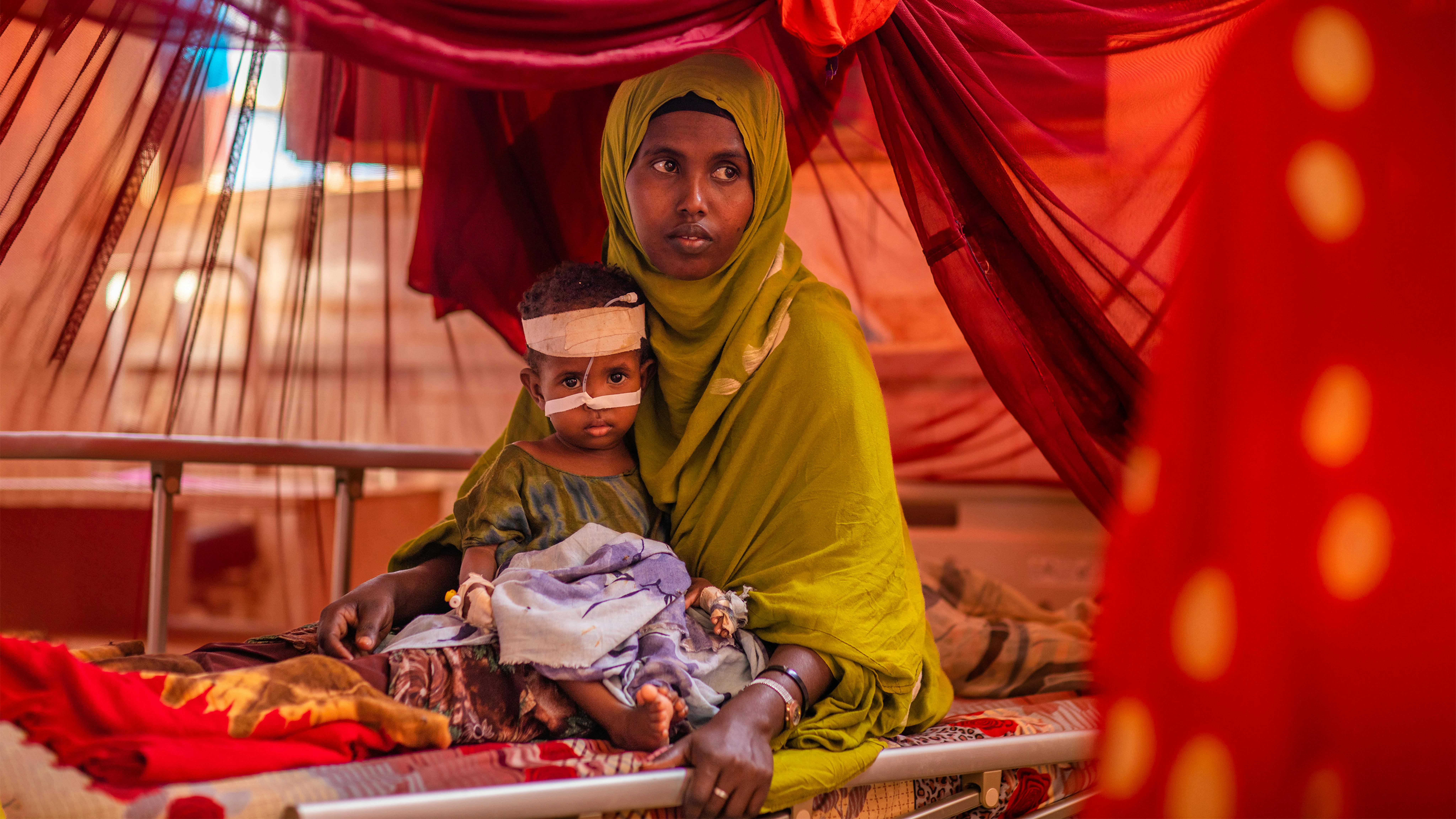 Etiopia, Ayan Muhammed si prende cura di suo figlio Fair mentre riceve cure nutrizionali presso il Centro di stabilizzazione dell'ospedale Gode supportato dall'UNICEF