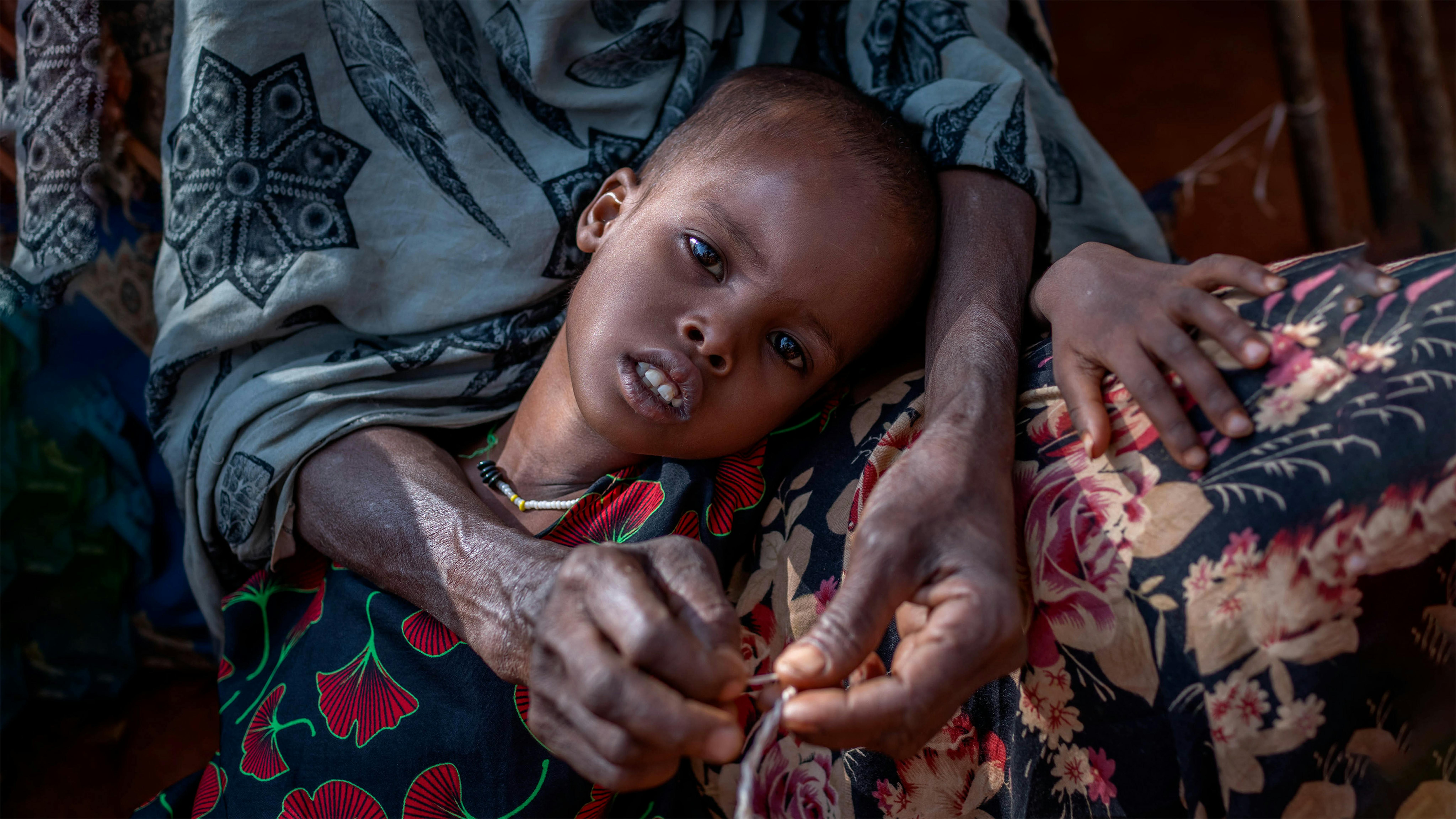 Bento Gameta è malnutrito. Sua madre Meriam Hussien è preoccupata che i suoi figli si ammalino. La mancanza di pioggia per tre stagioni consecutive ha portato ad una grave siccità nella regione dei somali, in Etiopia. 