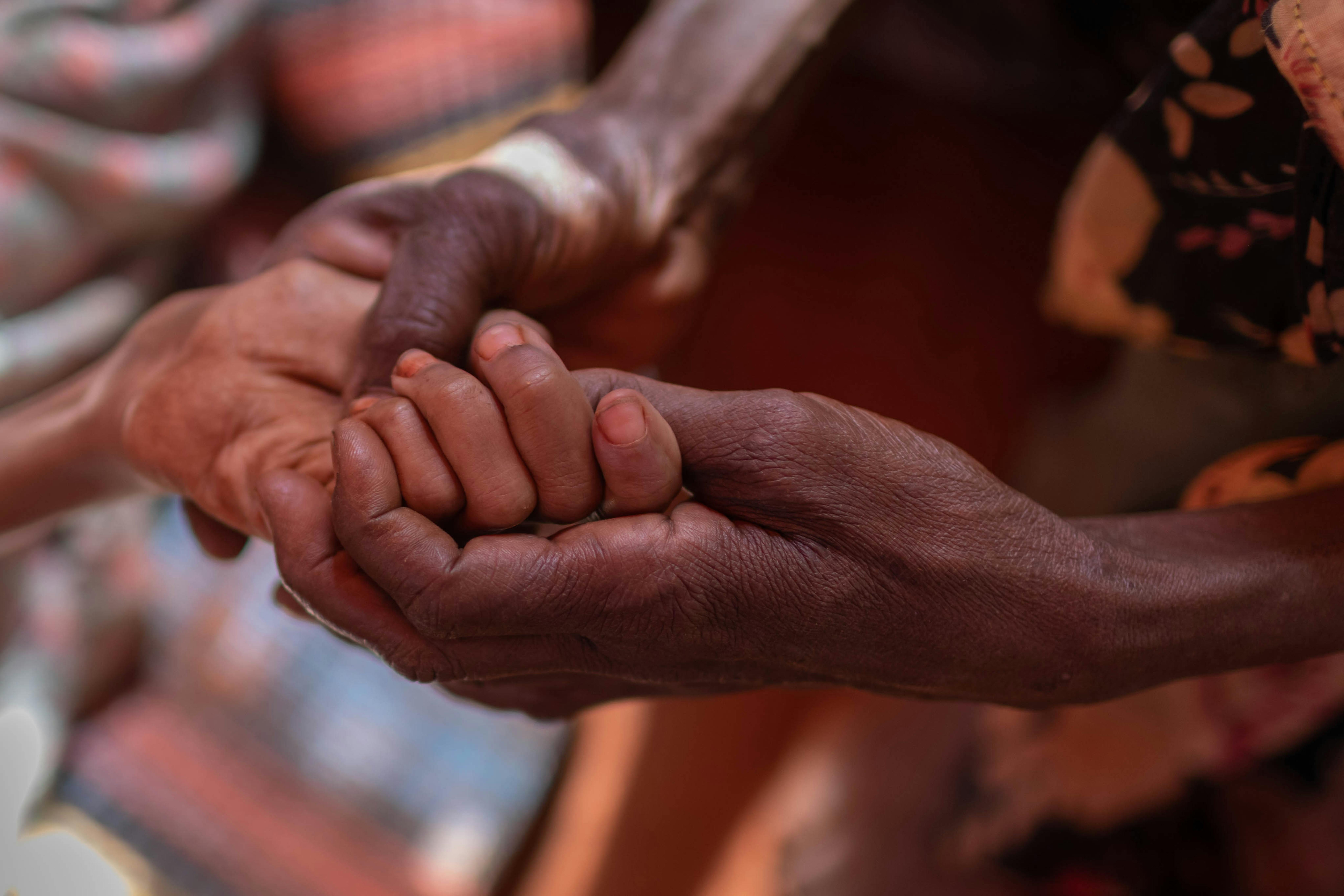 Una grave siccità nella regione dei Somali ha prosciugato pozzi d'acqua, uccidendo bestiame e rovinando colture, spingendo centinaia di persone  di migliaia di bambini e delle loro famiglie sull'orlo del baratro. La mano di una Dheg, gravemente malnutrito tra quelle di sua madre