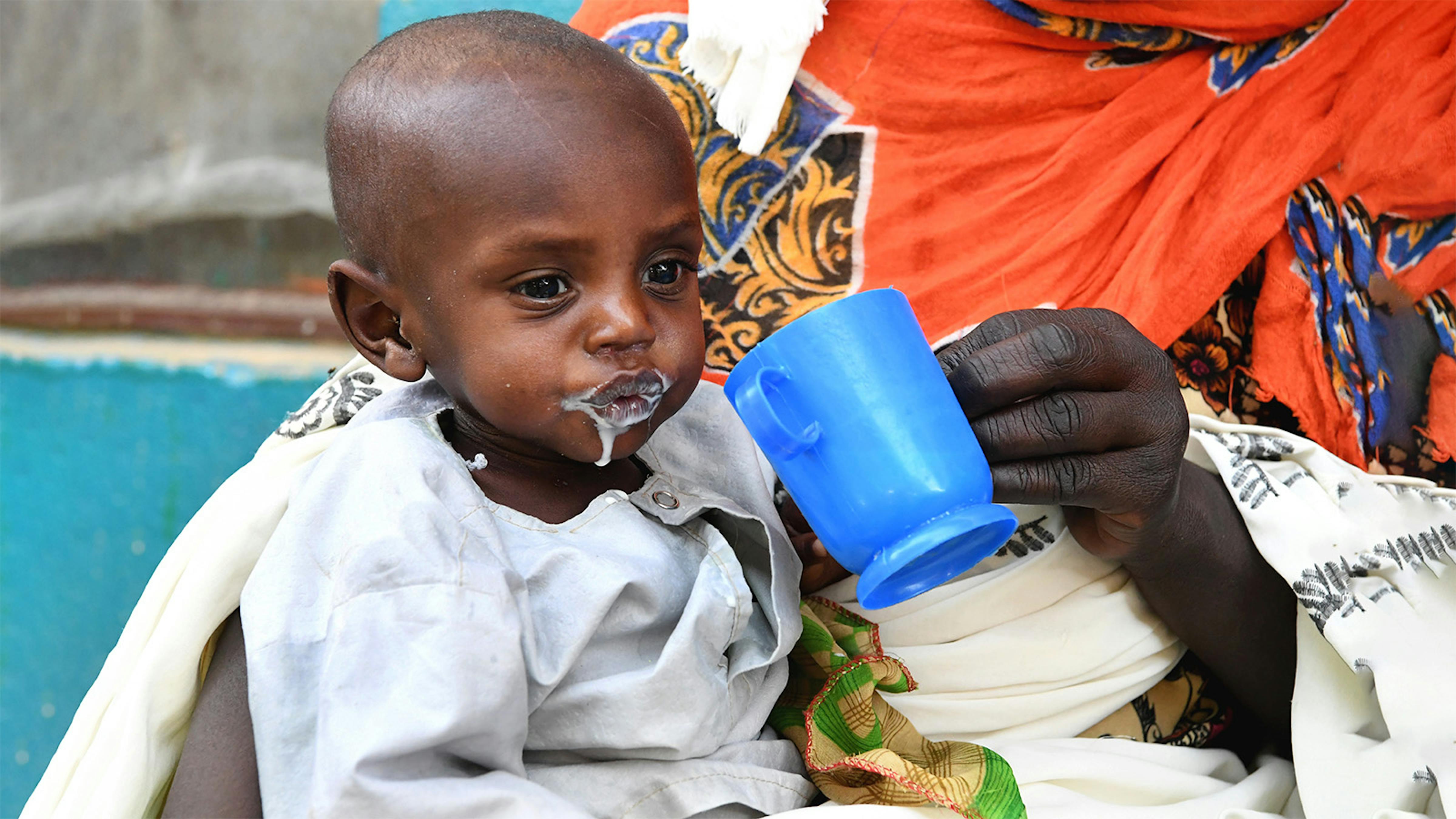 Un bambino si nutre con un integratore alimentare, presso l'ospedale provinciale di Abeche, nella parte orientale del Ciad