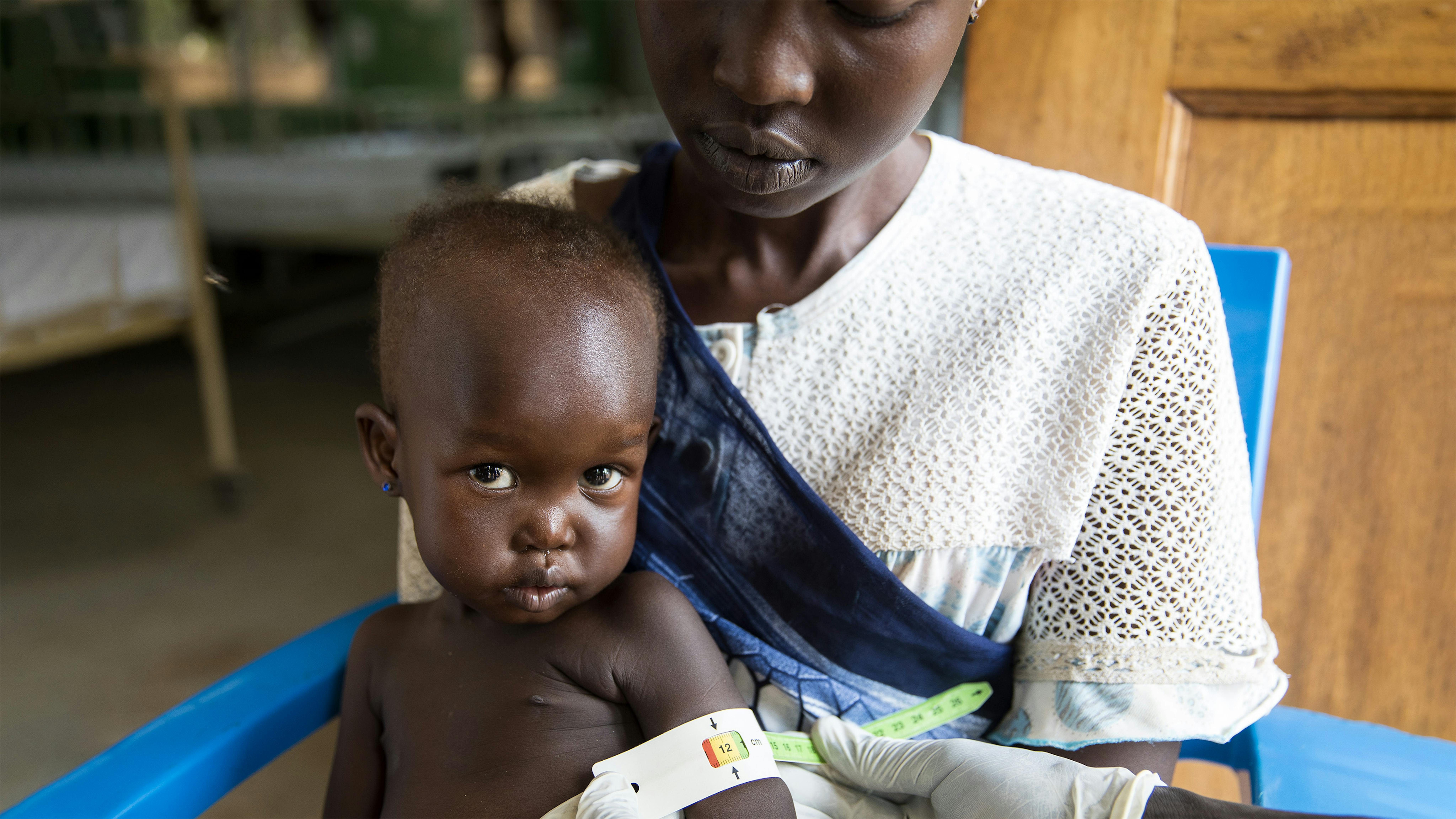 Sud Sudan - Theresa (26 anni) con la figlia Afra (2 anni e 4 mesi) nel reparto per bambini malnutriti dell'ospedale pediatrico Al Sabbah di Juba.