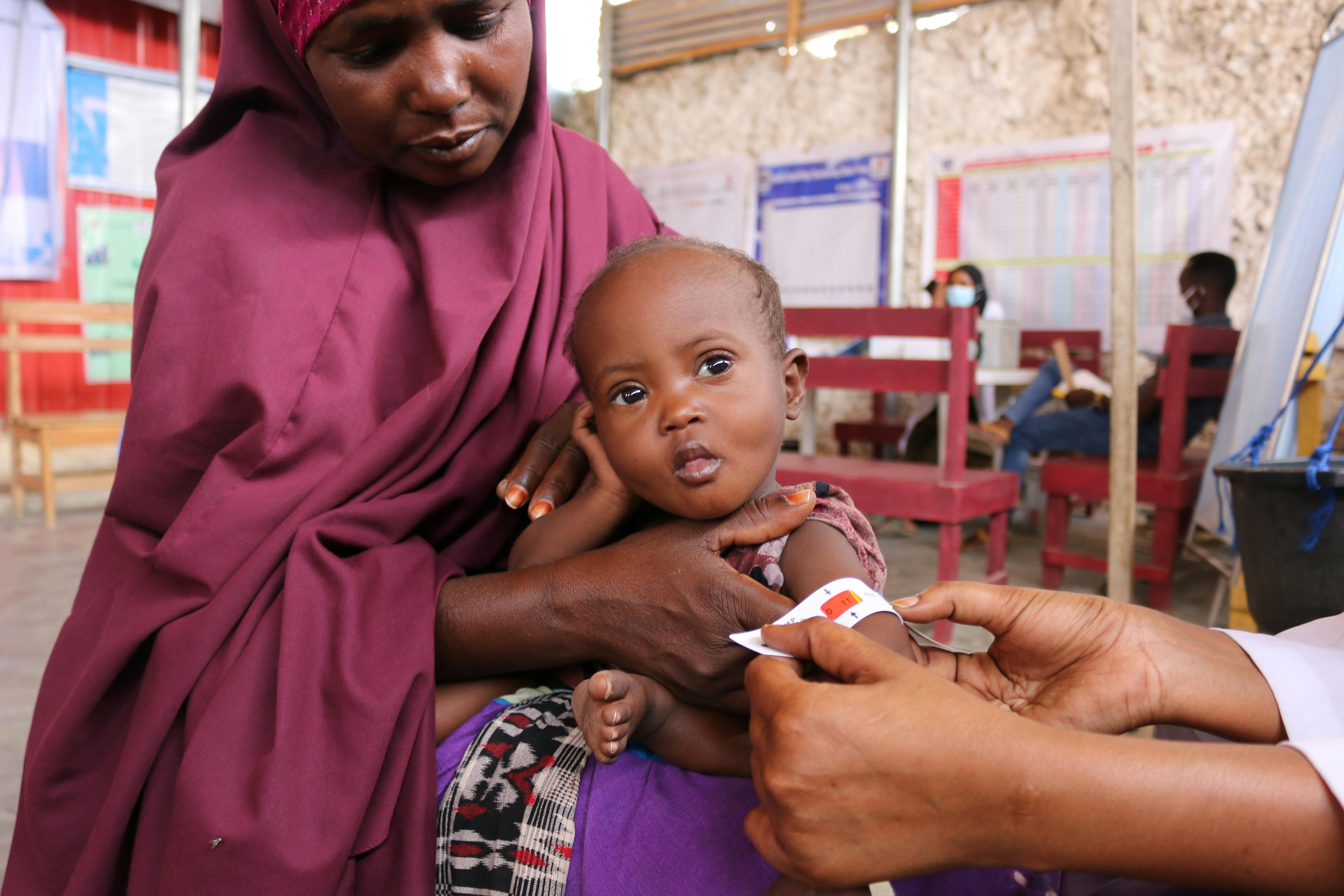 Un operatore sanitario utilizza il MUAC, per misurare la circonferenza del braccio di Sabirin, la figlia più giovane di Khadijo. Siamo nel Weydow Health Center, sostenuto dall'UNICEF, alla periferia di Mogadiscio, in Somalia.