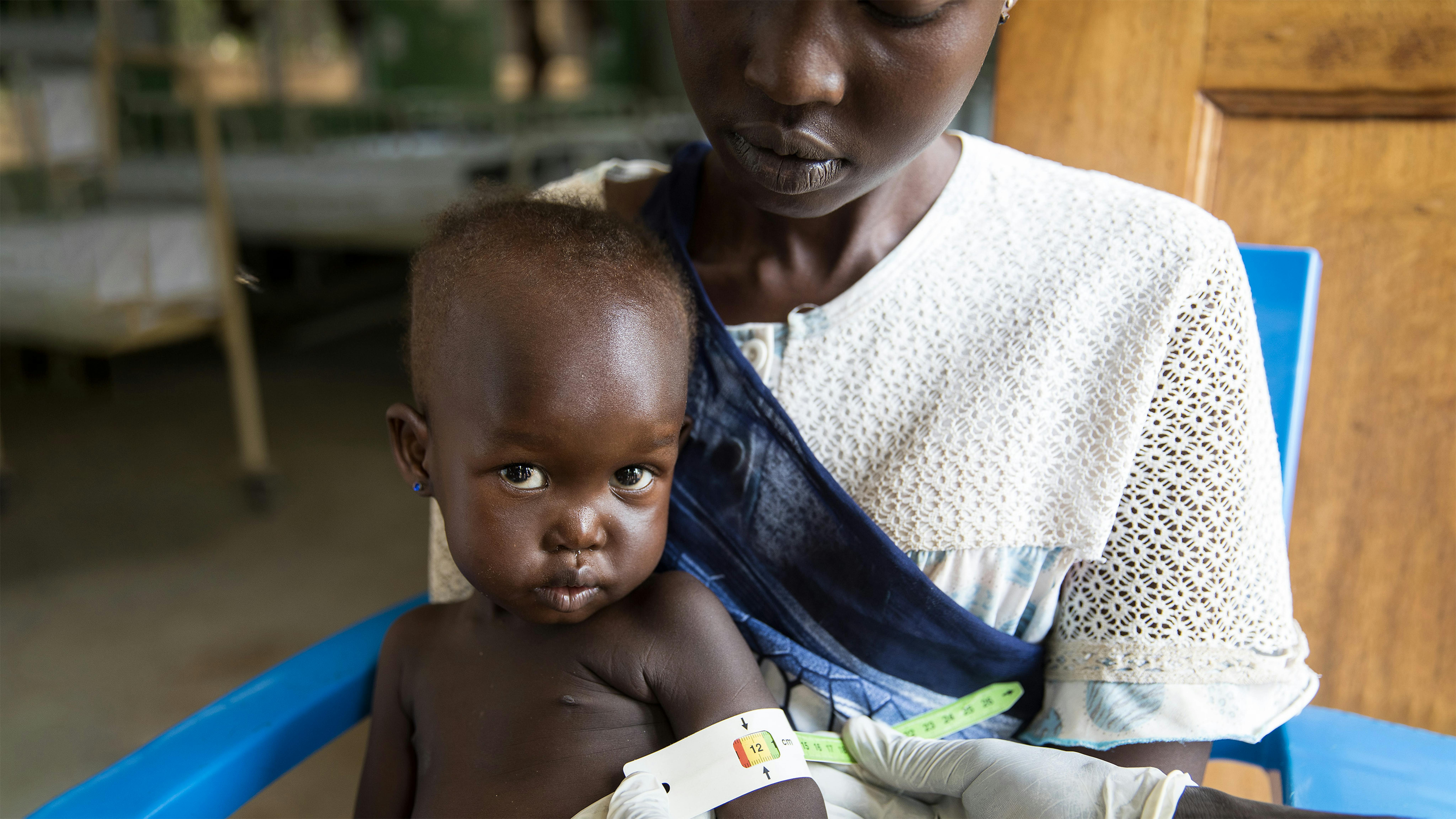 Sud Sudan Afra, con la mamma Therese, viene controllata per la malnutrizione all'ospedale pediatrico Al Sabbah di Juba