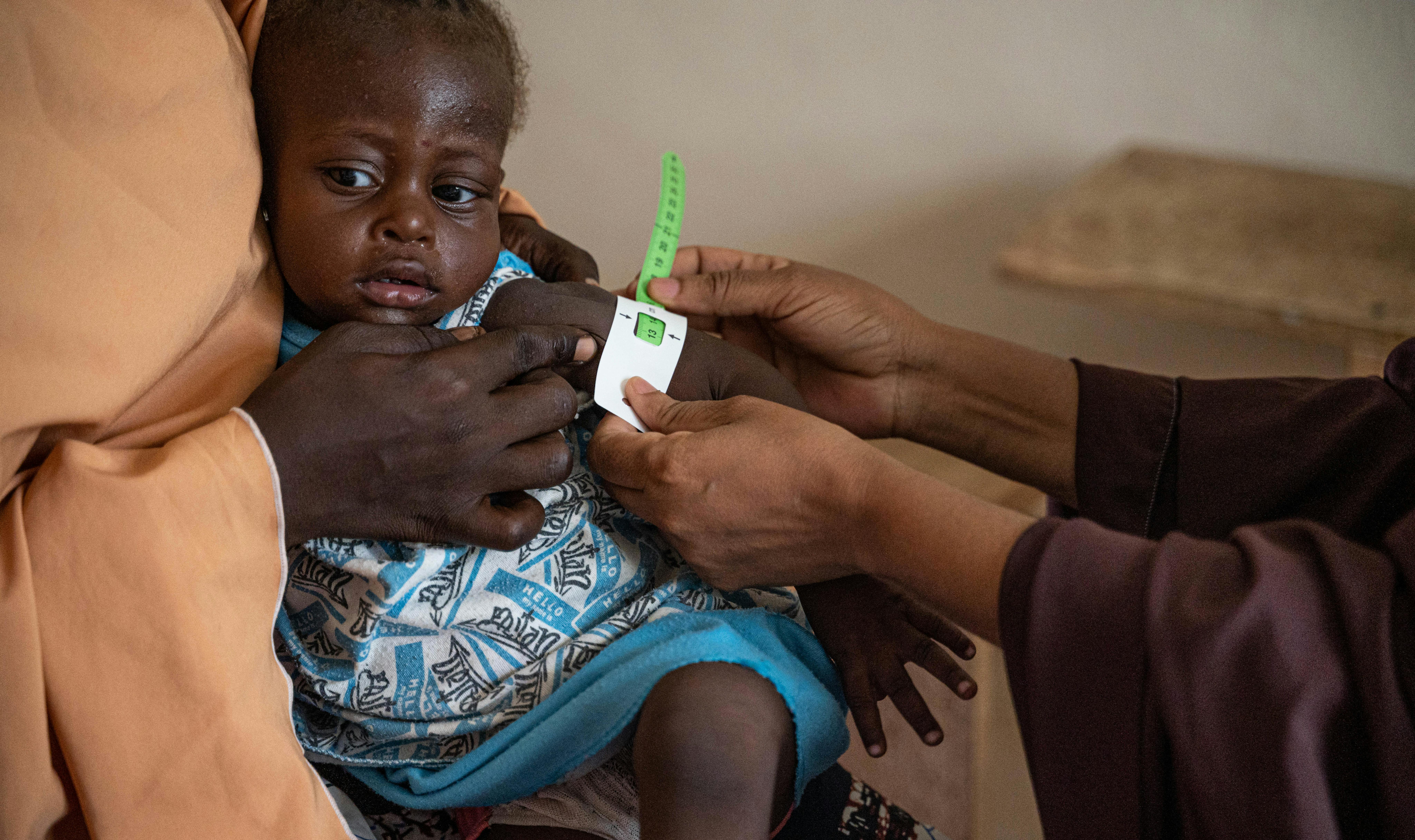 Nigeria, una bambina viene visitata al Primary Health Center di Bombori, Nguru LGA, Yobe State
