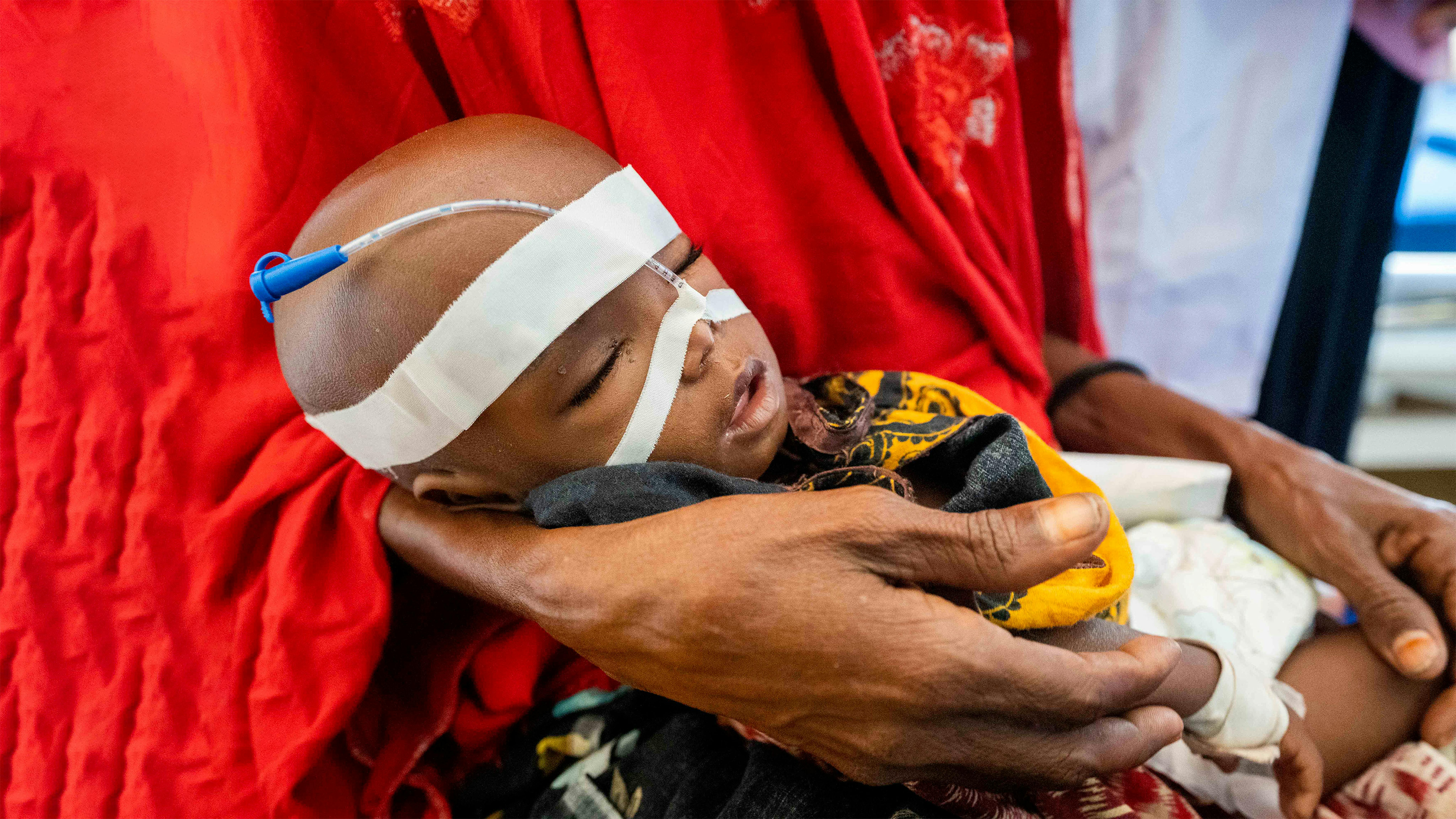 Somalia - Adam riposa sulle mani di sua nonna in un centro di stabilizzazione dell'ospedale di Banadir. È arrivato quattro giorni fa con complicazioni e grave malnutrizione