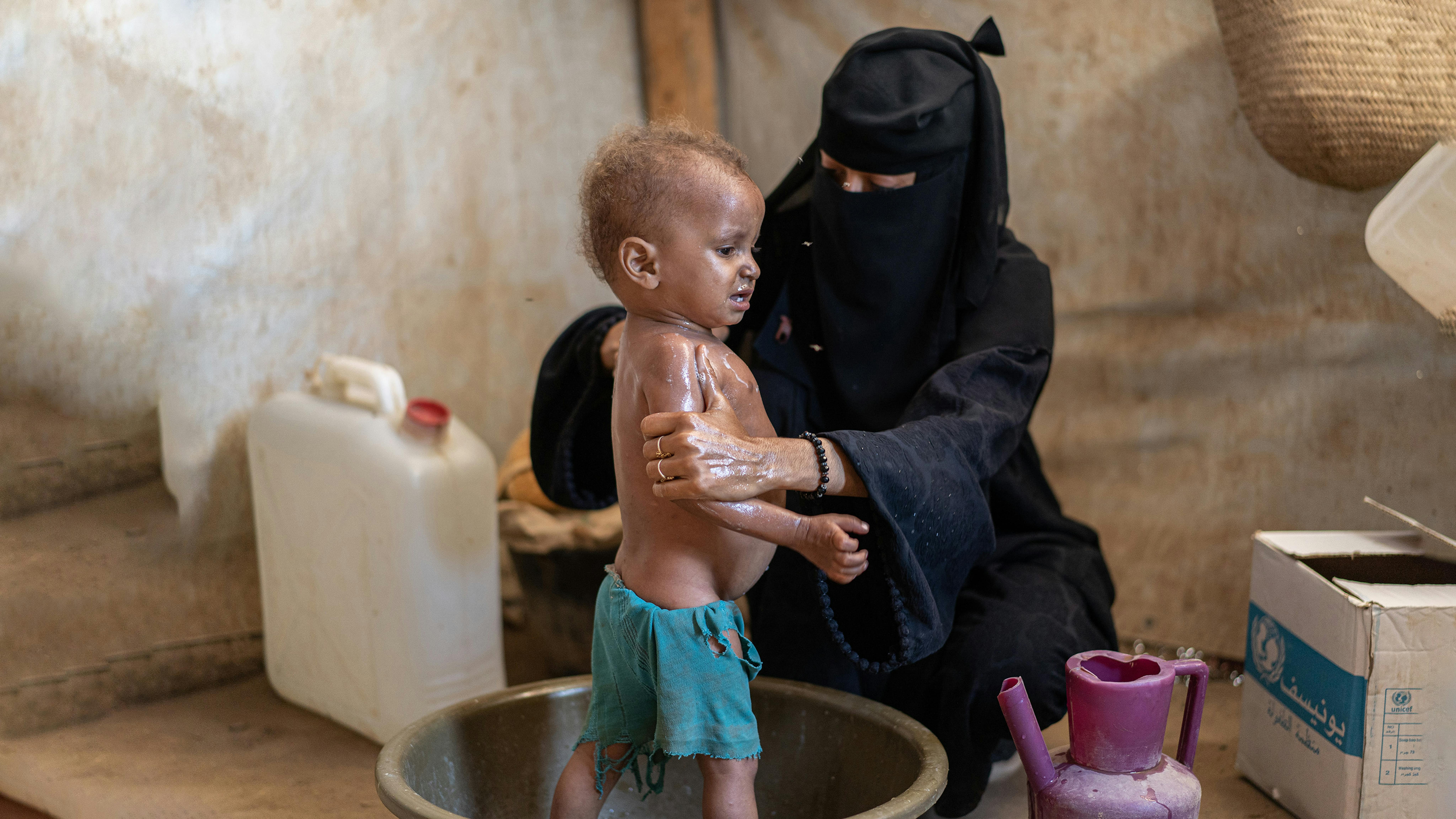 Fatima Ahmed, mentre fa il bagno a suo figlio Mohammed, nel campo di Al-Alili, distretto di Al Khawkhah, governatorato di Al-Hudaydah, Yemen.