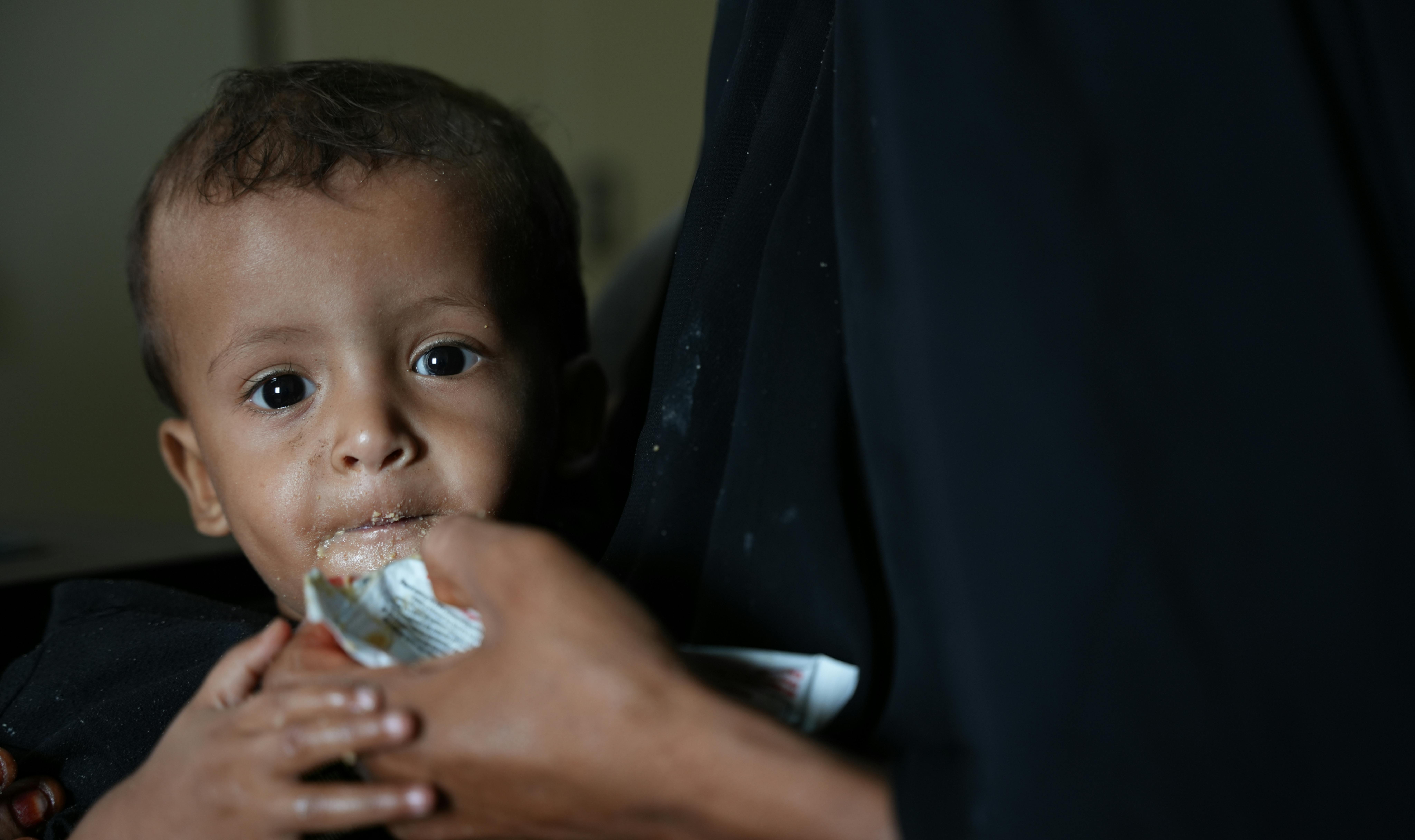 Yemen Ishraq mentre veniva nutrito con PlummyNut dopo il regolare controllo eseguito presso il centro sanitario di Al-khatabiah nel villaggio di Al-khatabiah,