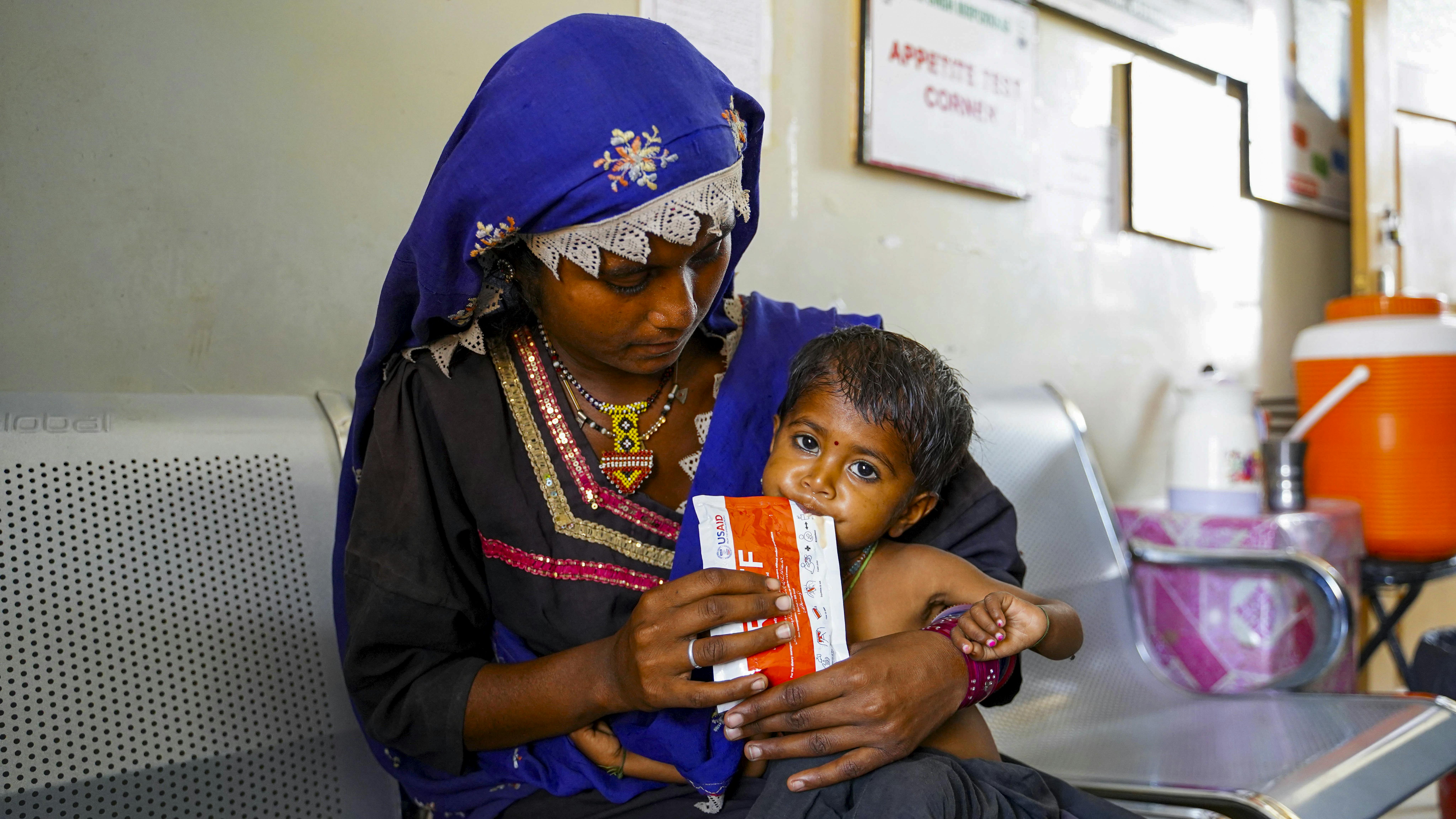Pakistan - Una madre nutre il suo bambino malnutrito con una pasta di arachidi nutriente (cibo terapeutico pronto all'uso) fornita dall'UNICEF.