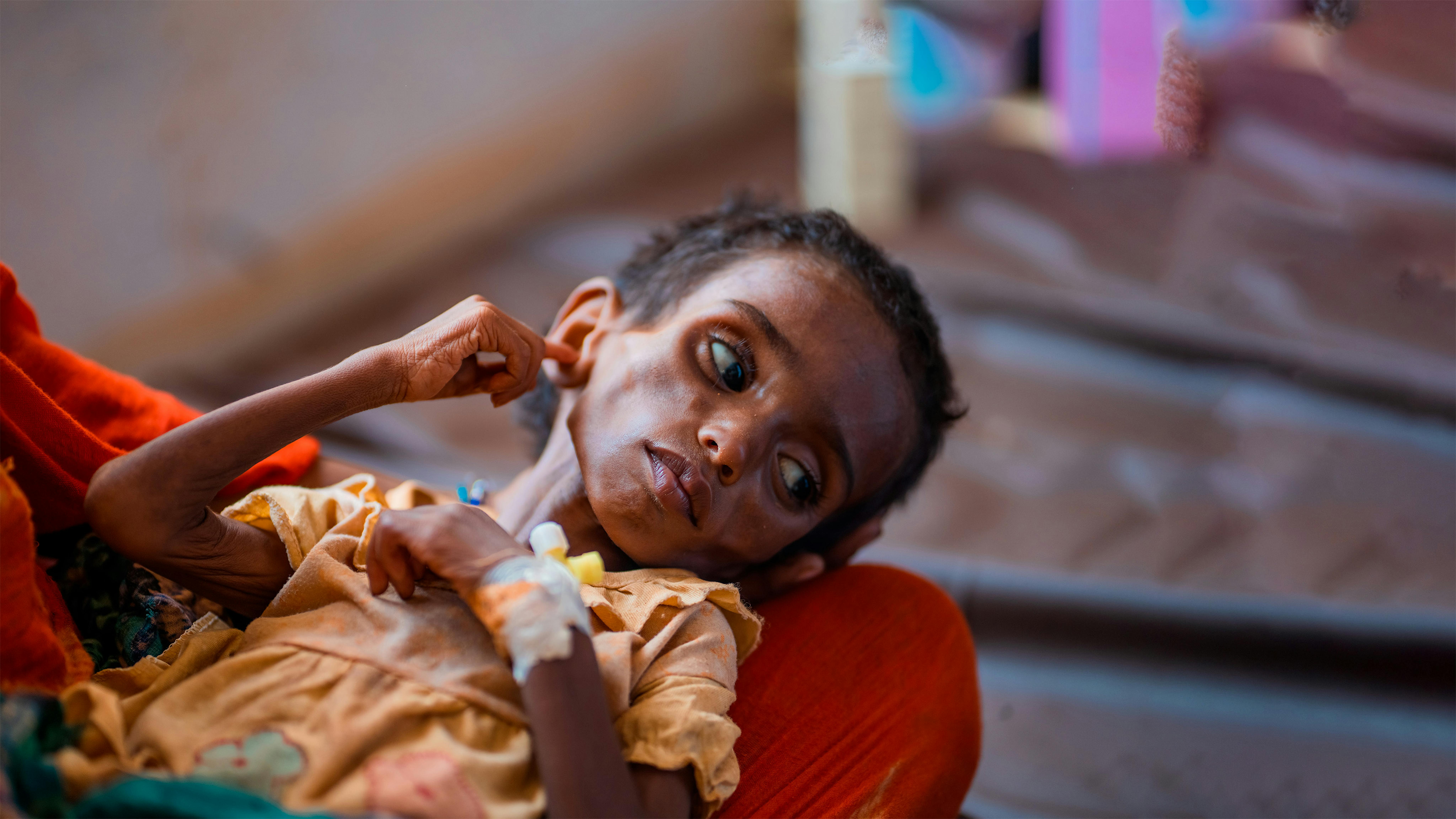 Mali - Rakiatou Walet Ibrahim, (28 mesi), malnutrito (MAS) ricoverato presso l'Intensive Nutritional Education Recovery Unit (URENI) dell'ospedale di Menaka è in cura grazie al sostegno dell'UNICEF