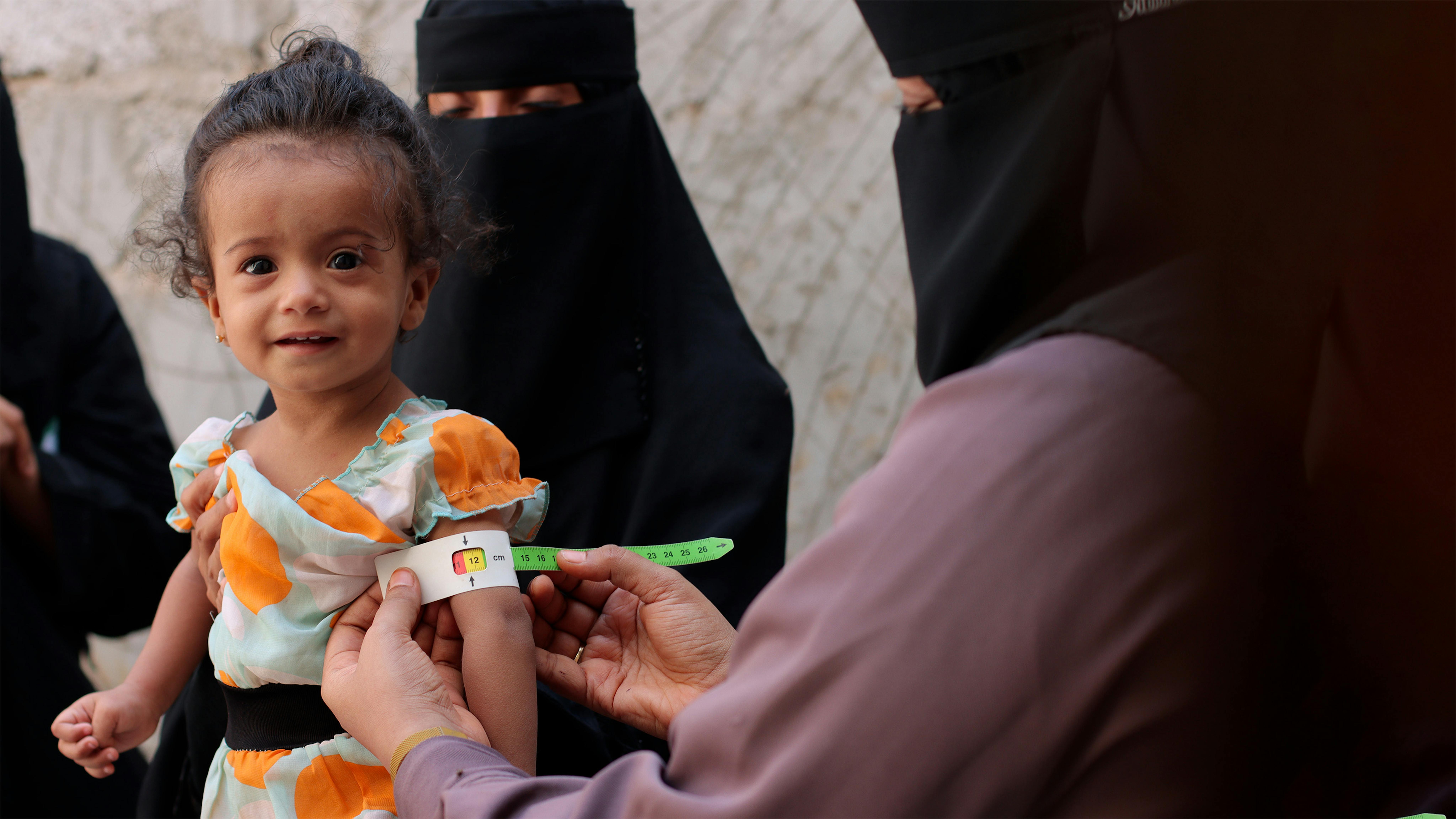 Yemen, Una bambina viene monitorata con il MUAC per verificare lo status nutrizionale