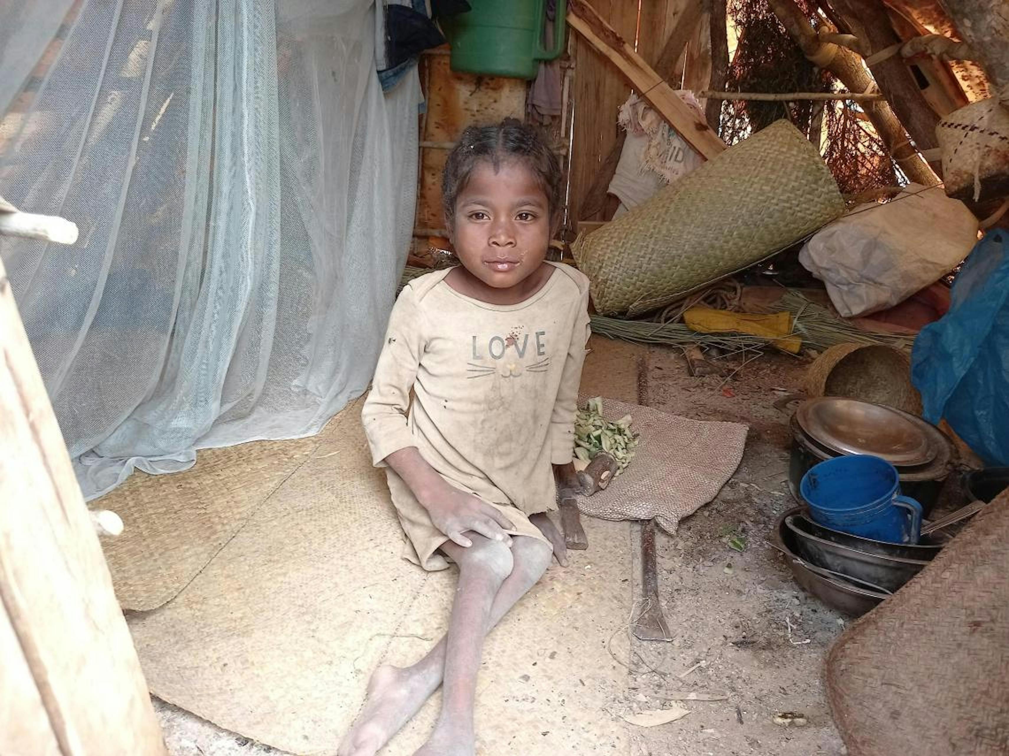 Tenasoa ha 14 anni e vive con una disabilità fisica. Incapace di camminare, si trascina ogni giorno per raggiungere la miniera di mica ed estrarre almeno 2 kili di mica al giorno.