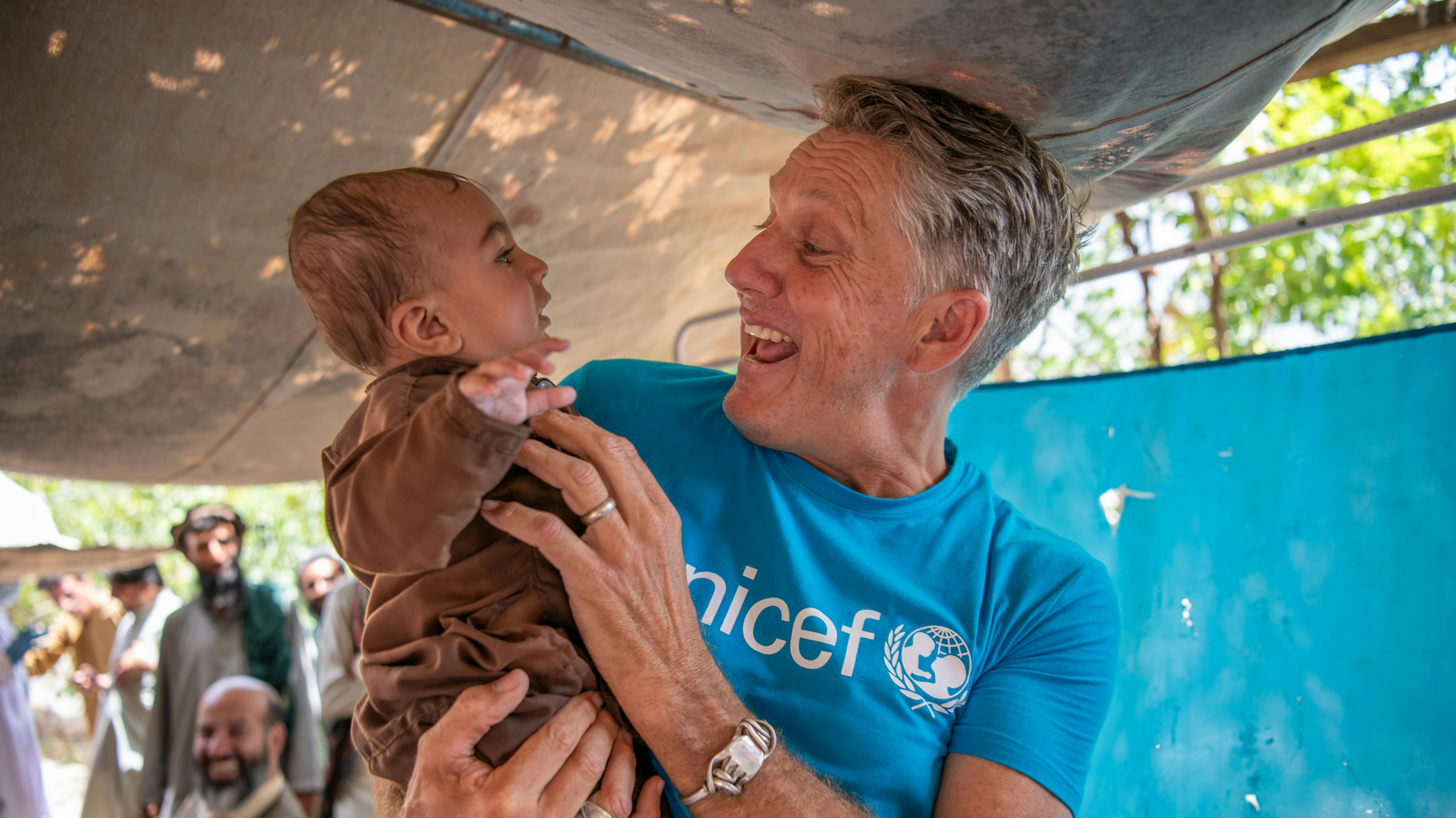 James Elder, portavoce dell'UNICEF, gioca con un bambino nelle squadre mobili di salute e nutrizione (MHNT) supportate dall'UNICEF a Samsagal
