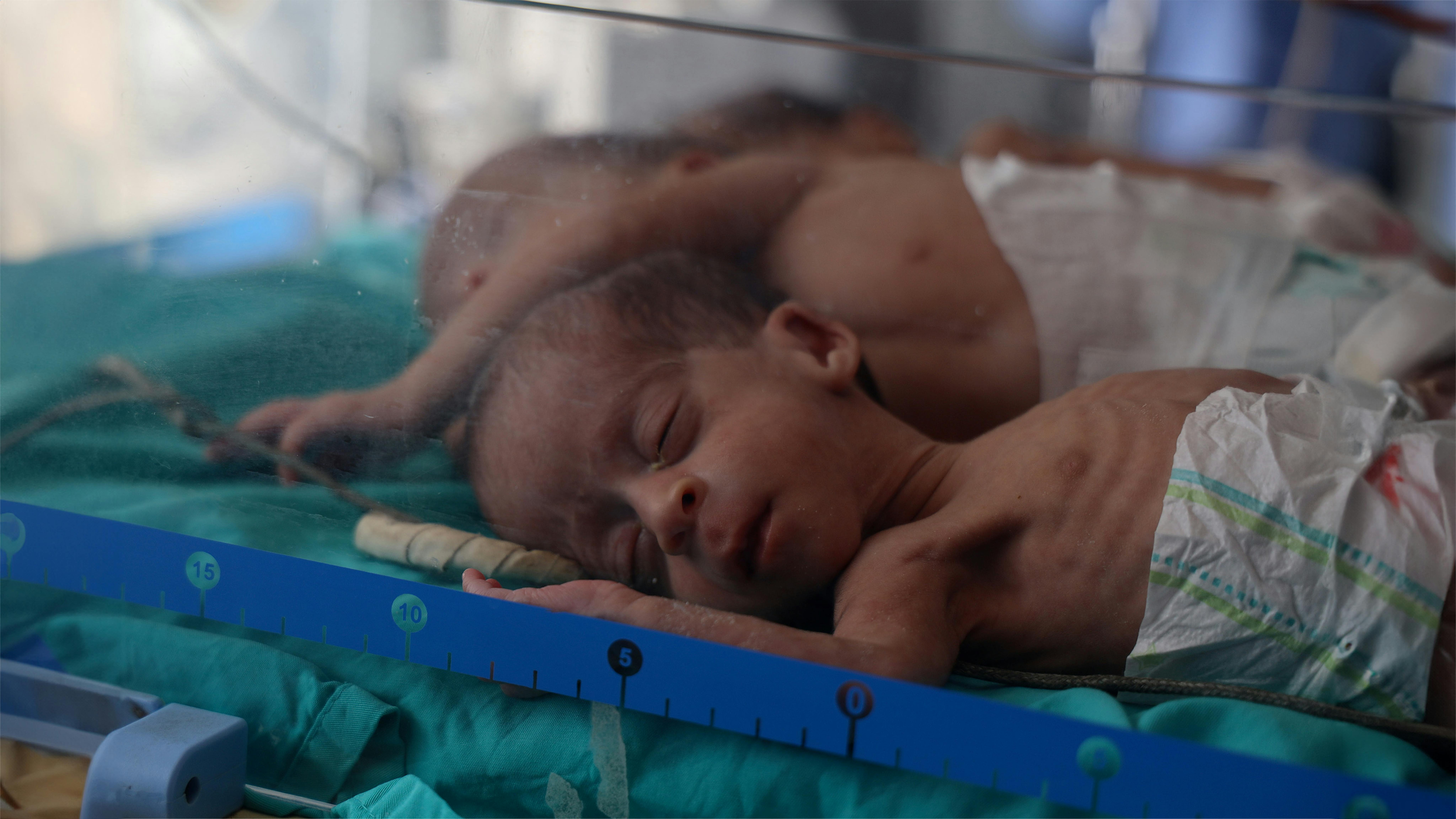 I bambini salvati dall’ospedale Al-Shifa, nel nord di Gaza, vengono trasferiti all’ospedale Al-Helal Al-Emarati di Rafah, nel sud della Striscia.
