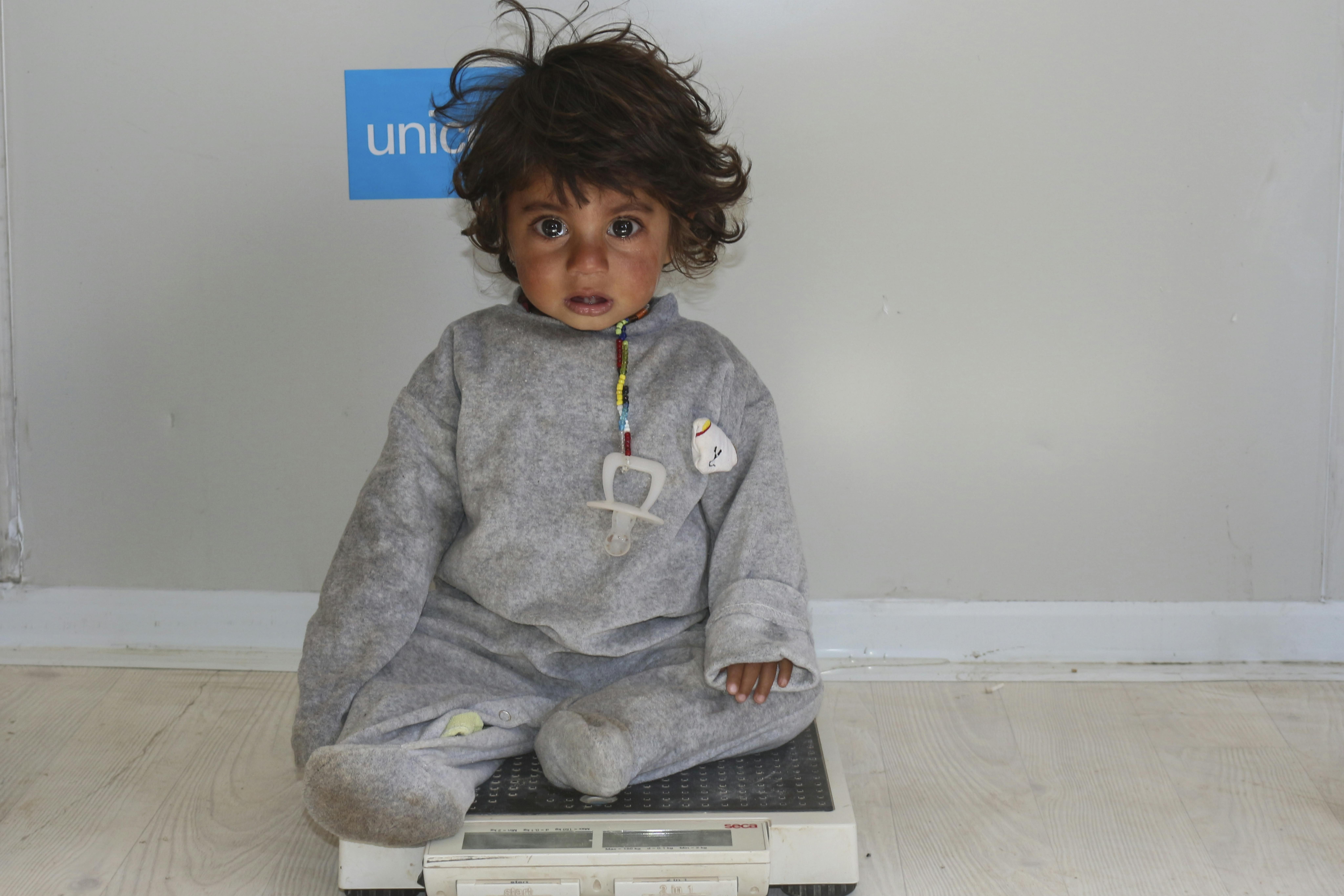 Siria: Mahmoud, 14 mesi, vive nel campo profughi di Al-Hol. Sta indossando un braccialetto speciale MUAC, che serve per determinare il grado di malnutrizione dei bambini. Come lui, altri 3,7 milioni di bambini siriani hanno sviluppato forme di malnutrizione a causa delle guerra che da 13 anni devasta il paese. L'UNICEF è sul campo per curarli dalla malnutrizione con alimenti terapeutici e interventi di prevenzione