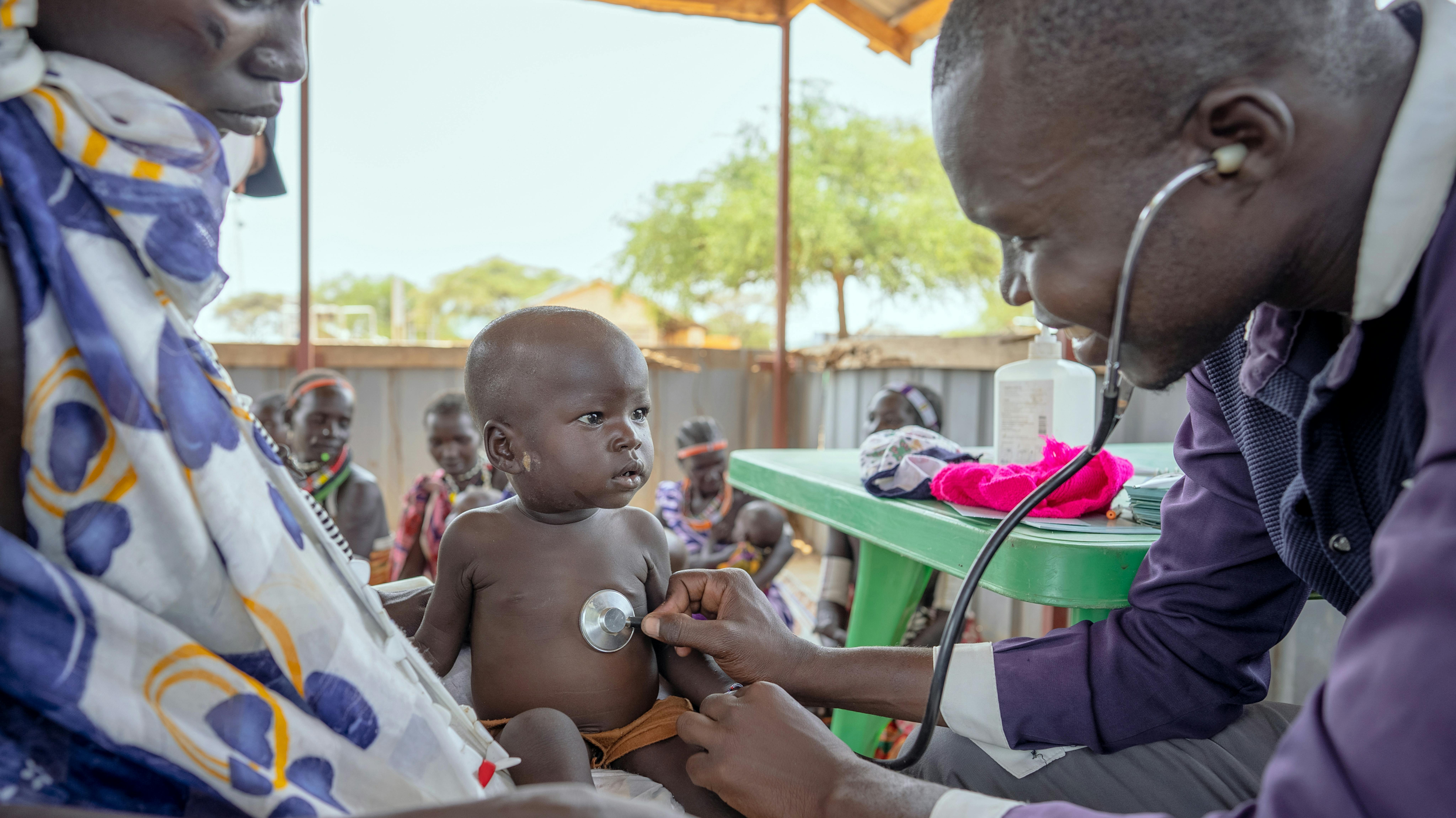 Sudan - un bambino viene sottoposto a visita medica e valutato per malnutrizione presso il centro di assistenza sanitaria primaria di Riwoto, sostenuto dall'UNICEF, nello stato dell'Equatoria orientale