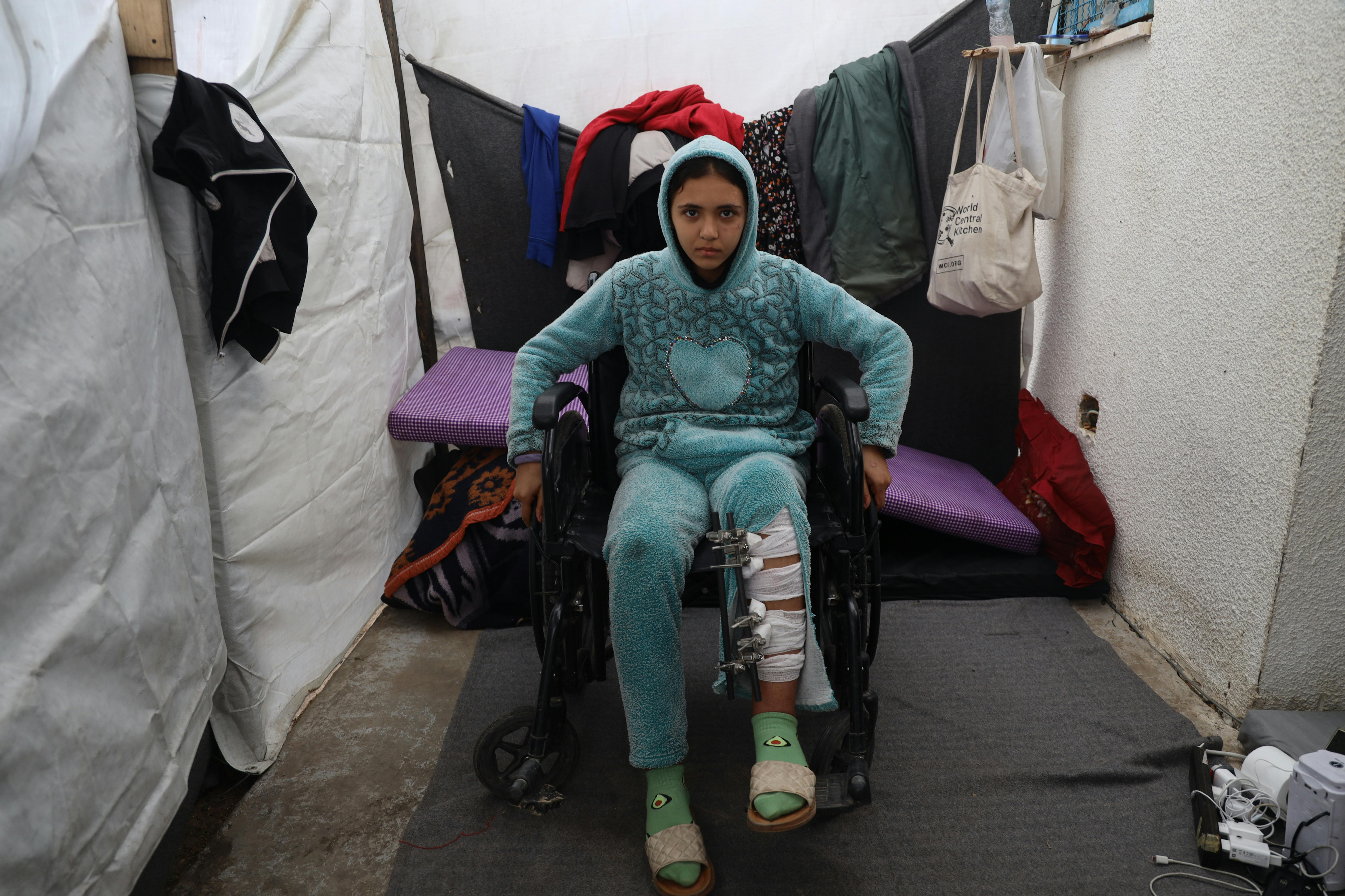 11 gennaio 2024, centro di accoglienza nella zona industriale di Khan Yunis, nel sud di Gaza, Mays, 13 anni, seduta su una sedia a rotelle a causa di una ferita alla gamba.